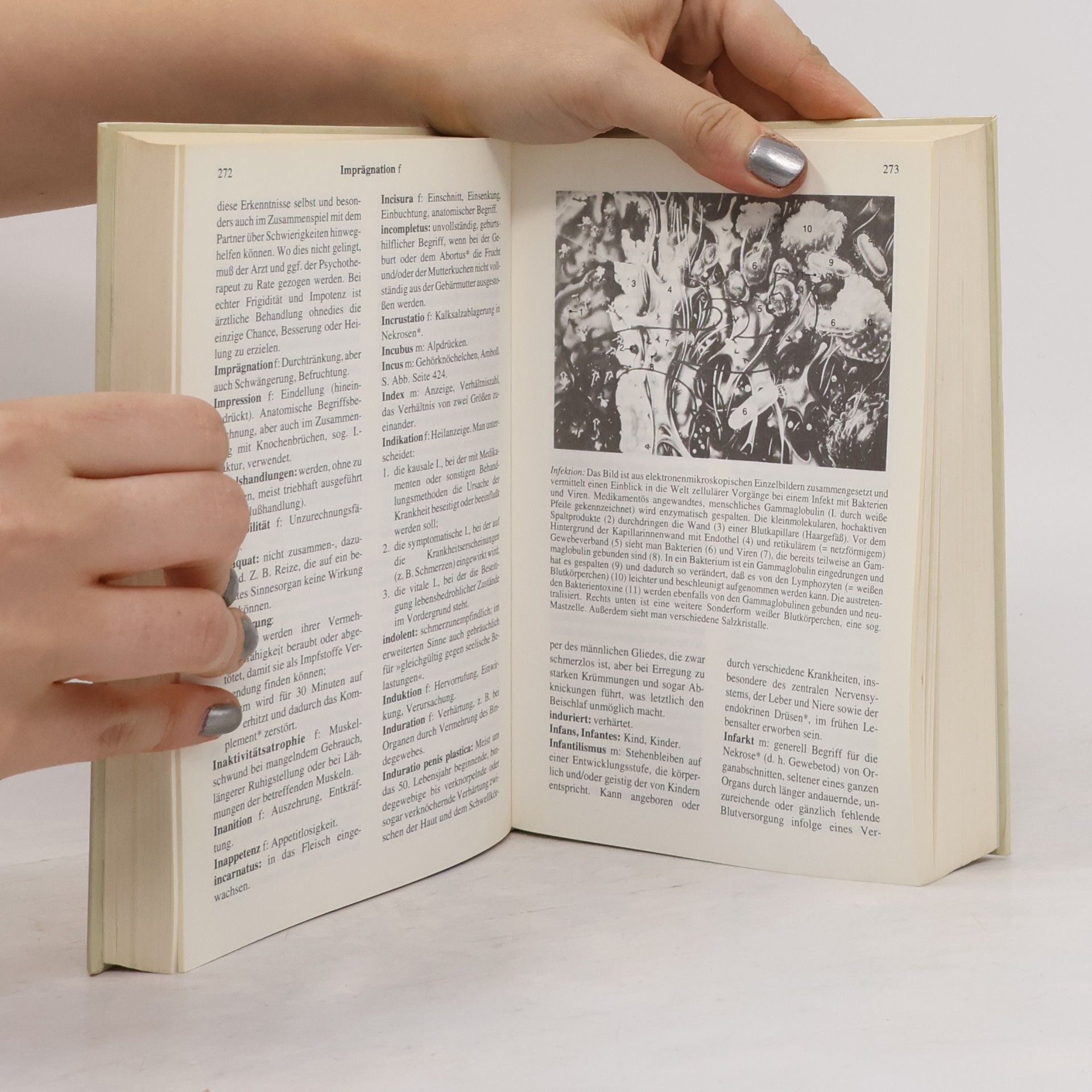 Autorenkollektiv Wörterbuch der medizinischen Fachaudrücke
