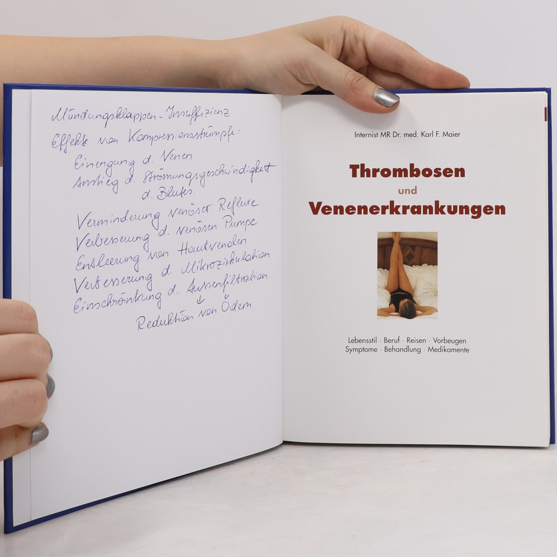 Karl F. Maier Thrombosen und Venenerkrankungen