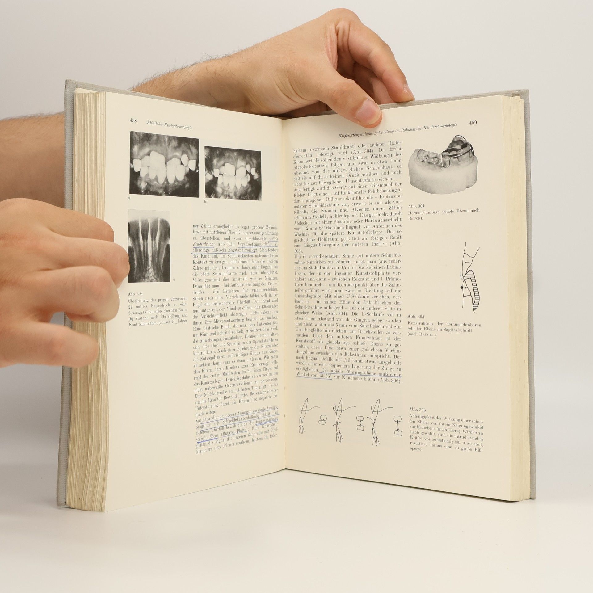 W. Künzel Kinderstomatologie