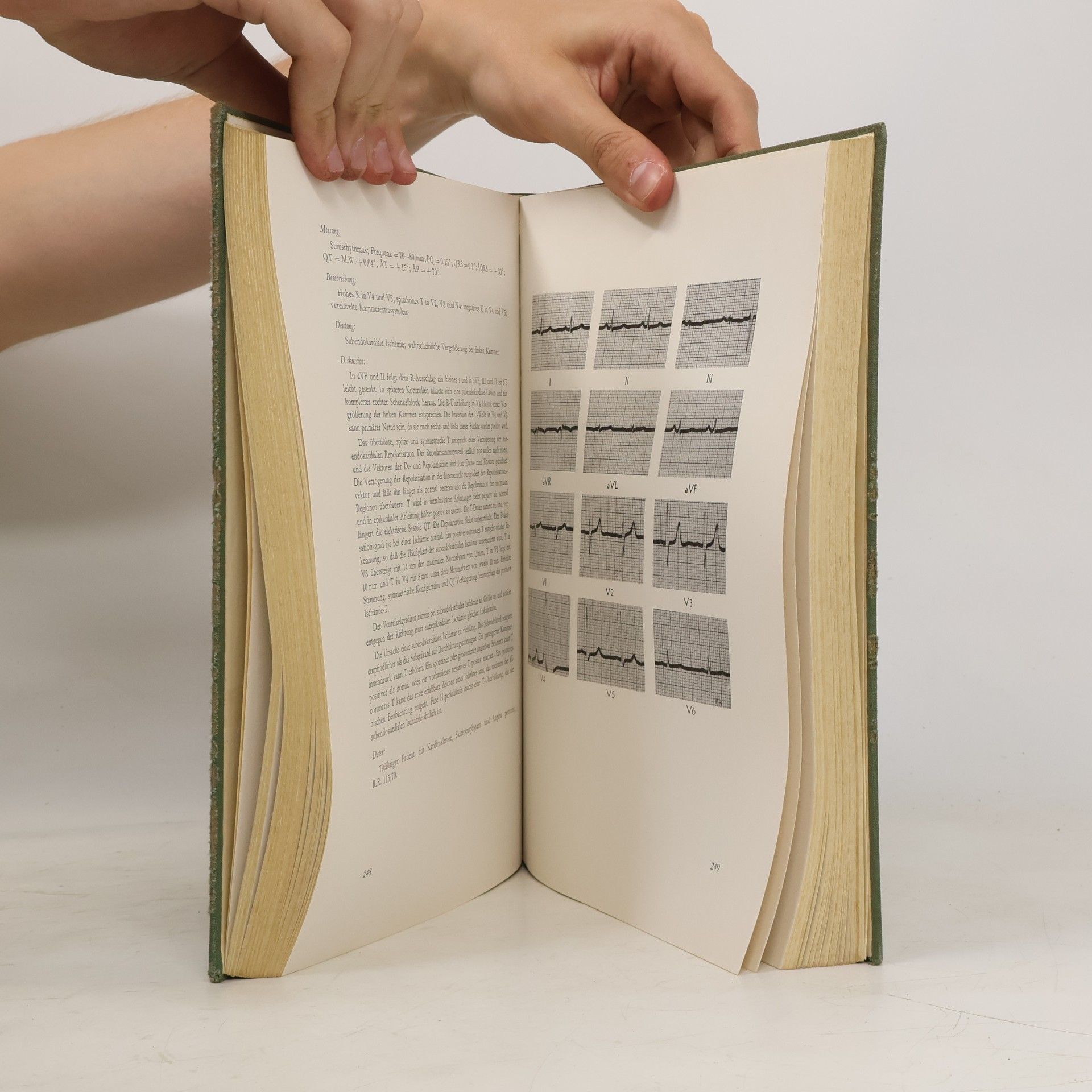 Rudolf Zuckermann Atlas der Elektrokardiographie