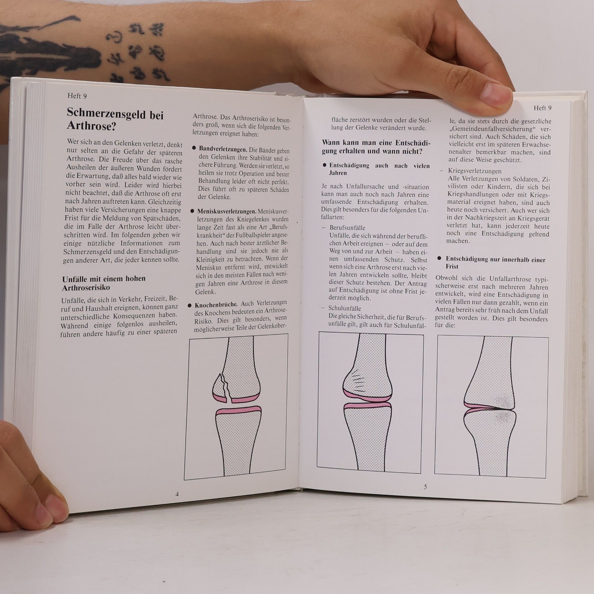 Kolektiv autorů Arthrose info Nr. 1-20