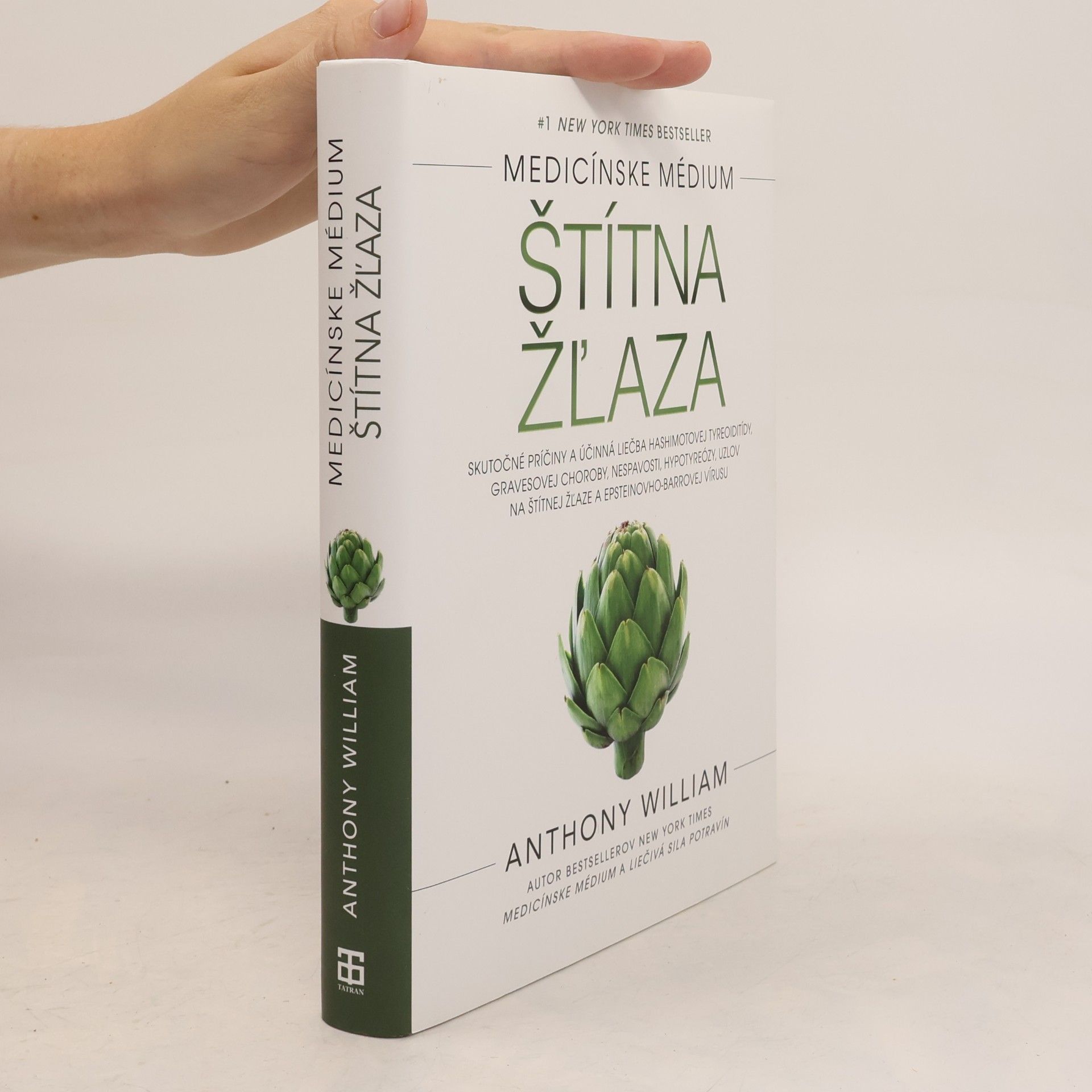 Anthony William Štítna žľaza