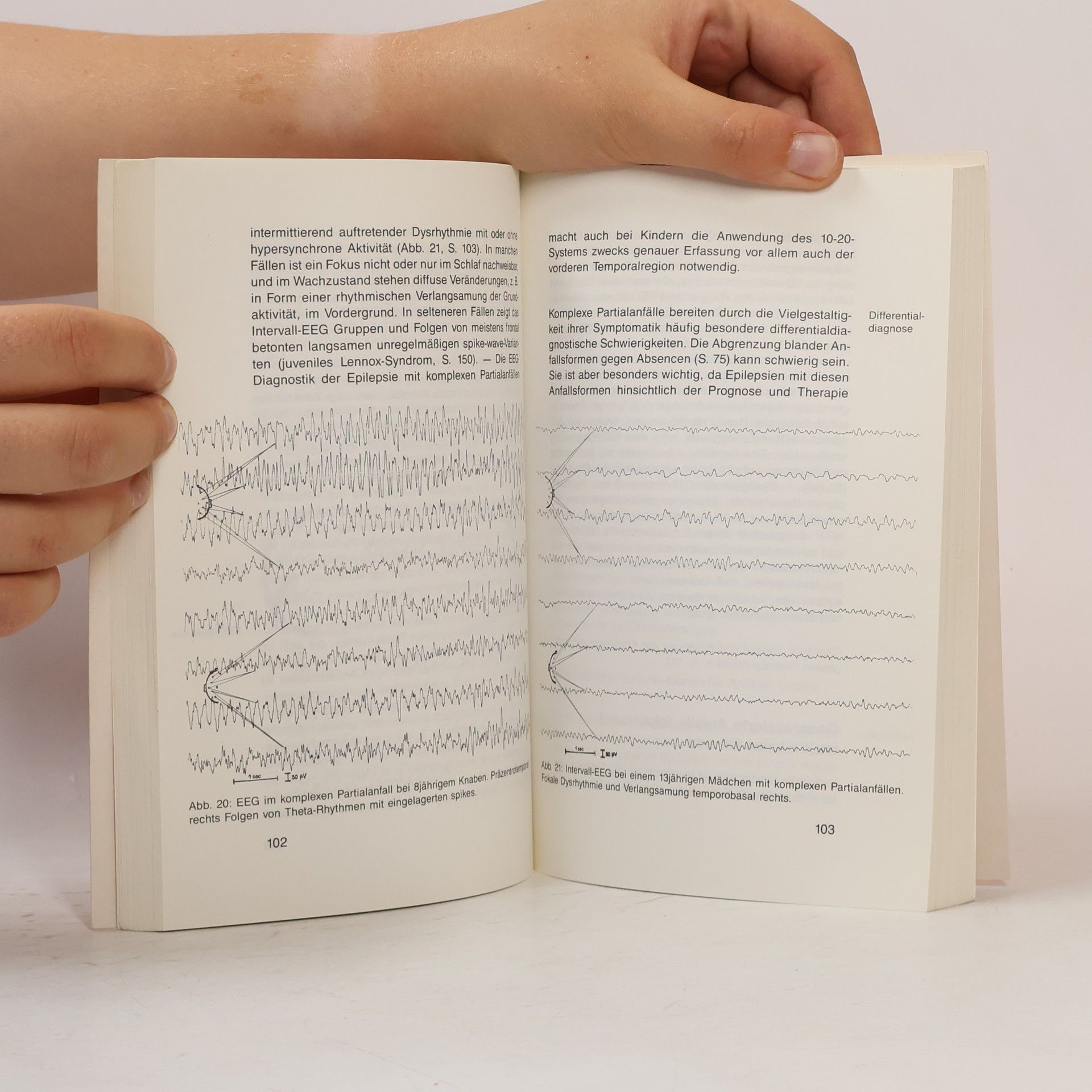 Hermann Doose Epilepsie im Kindes und Jugendalter