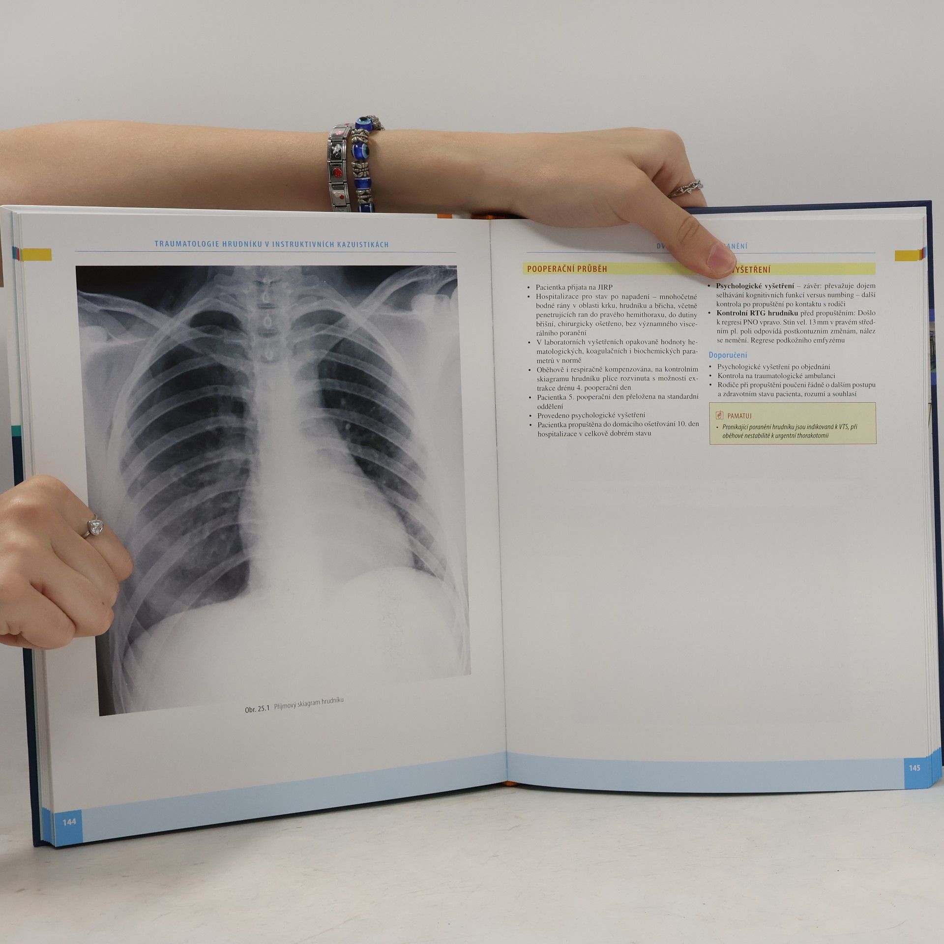 Vladislav Hytych Traumatologie hrudníku v instruktivních kazuistikách