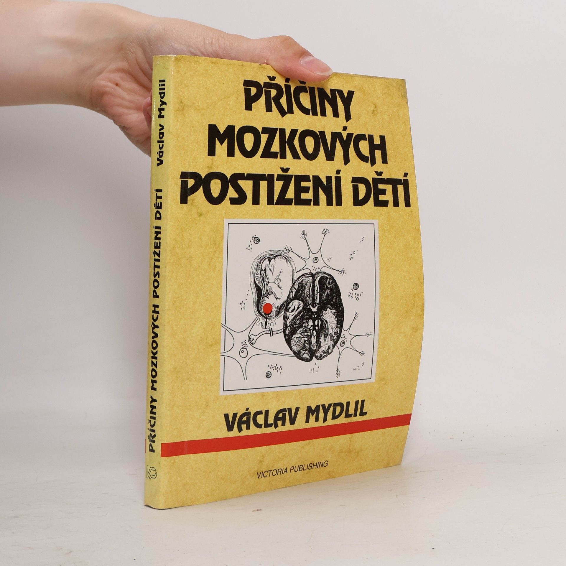 Václav Mydlil Příčiny mozkových postižení dětí
