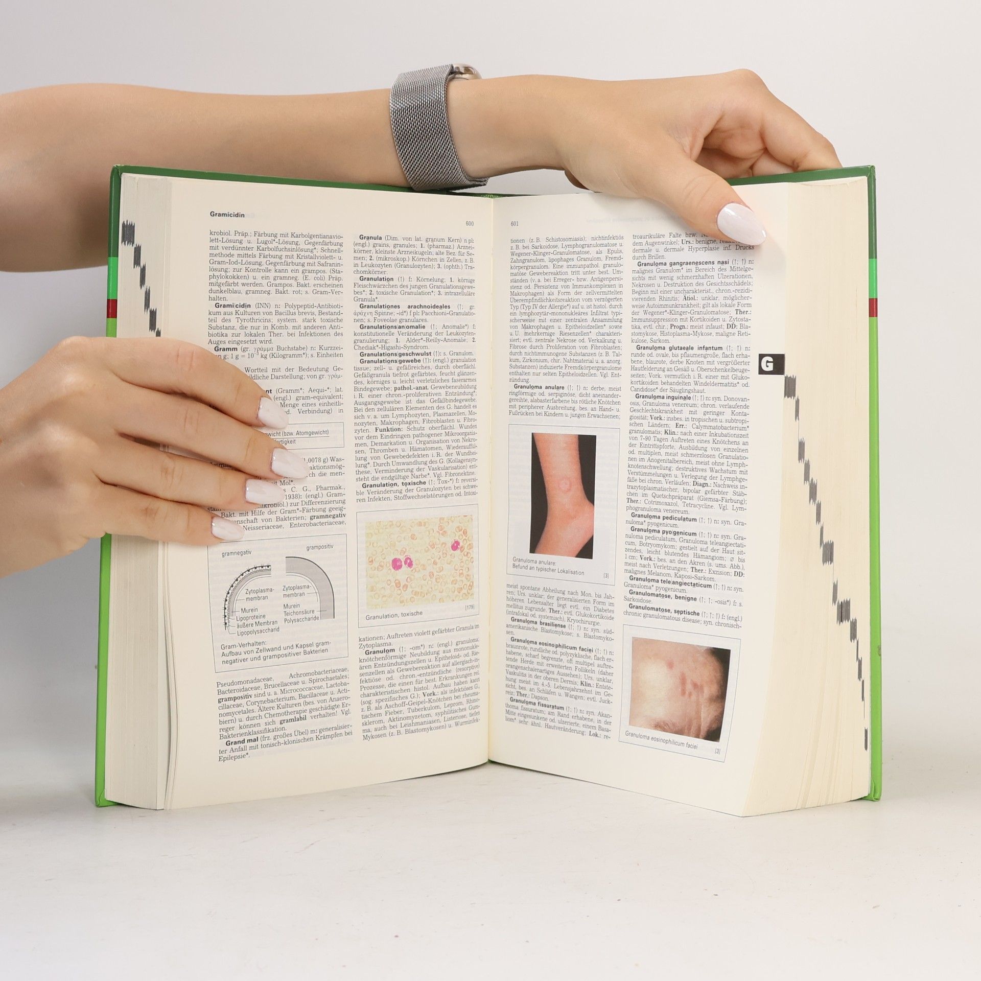 Autorenkollektiv Pschyrembel. Klinisches Wörterbuch 258