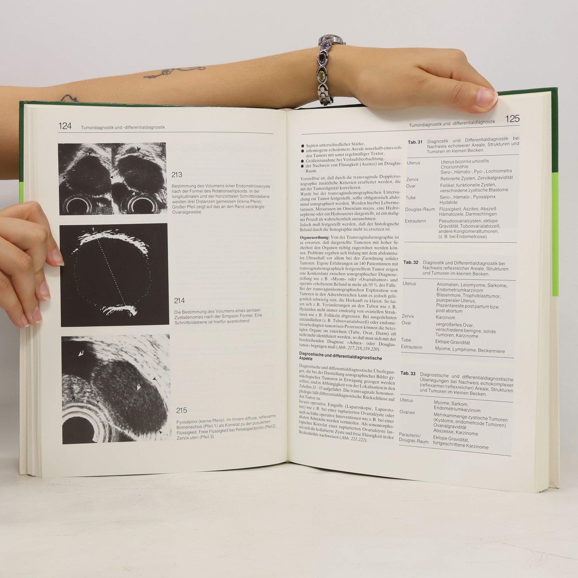Thomas Sautter Transvaginalsonographie