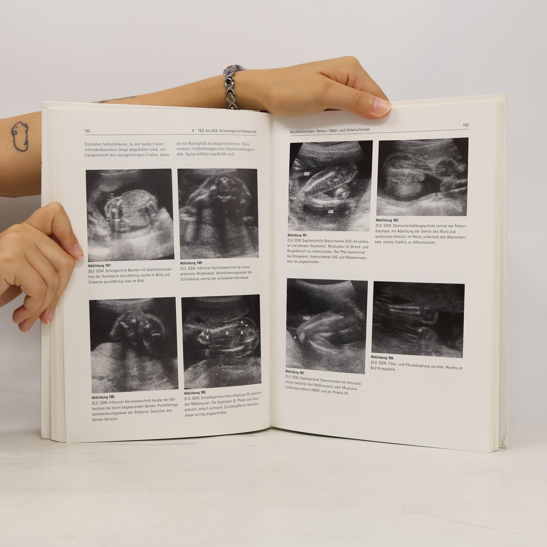 Klaus Meinel Fetale Sonoanatomie