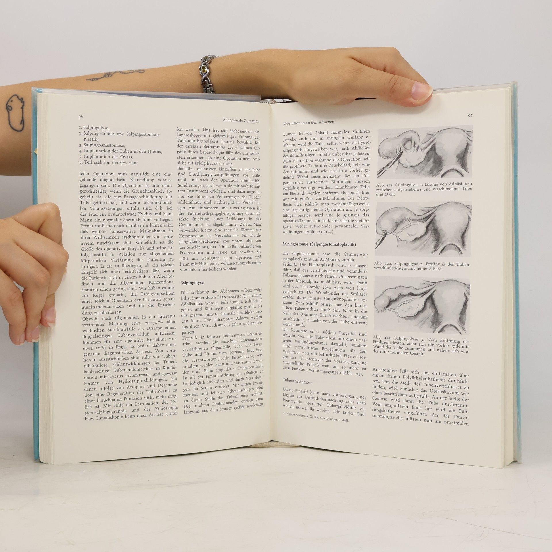 Hugo Husslein Die gynäkologischen Operationen und ihre topographisch-anatomischen Grundlagen