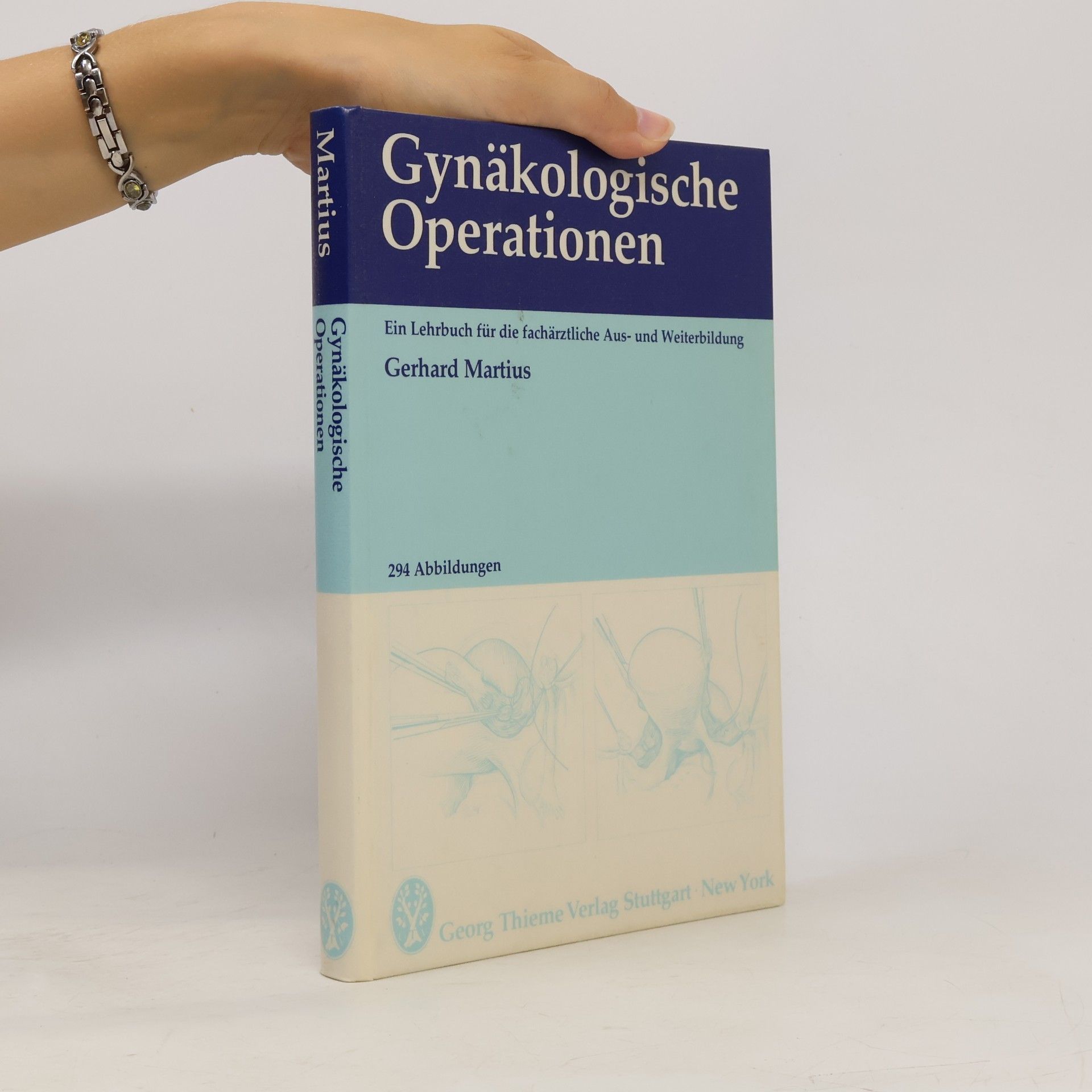 Gerhard Martius Gynäkologische Operationen