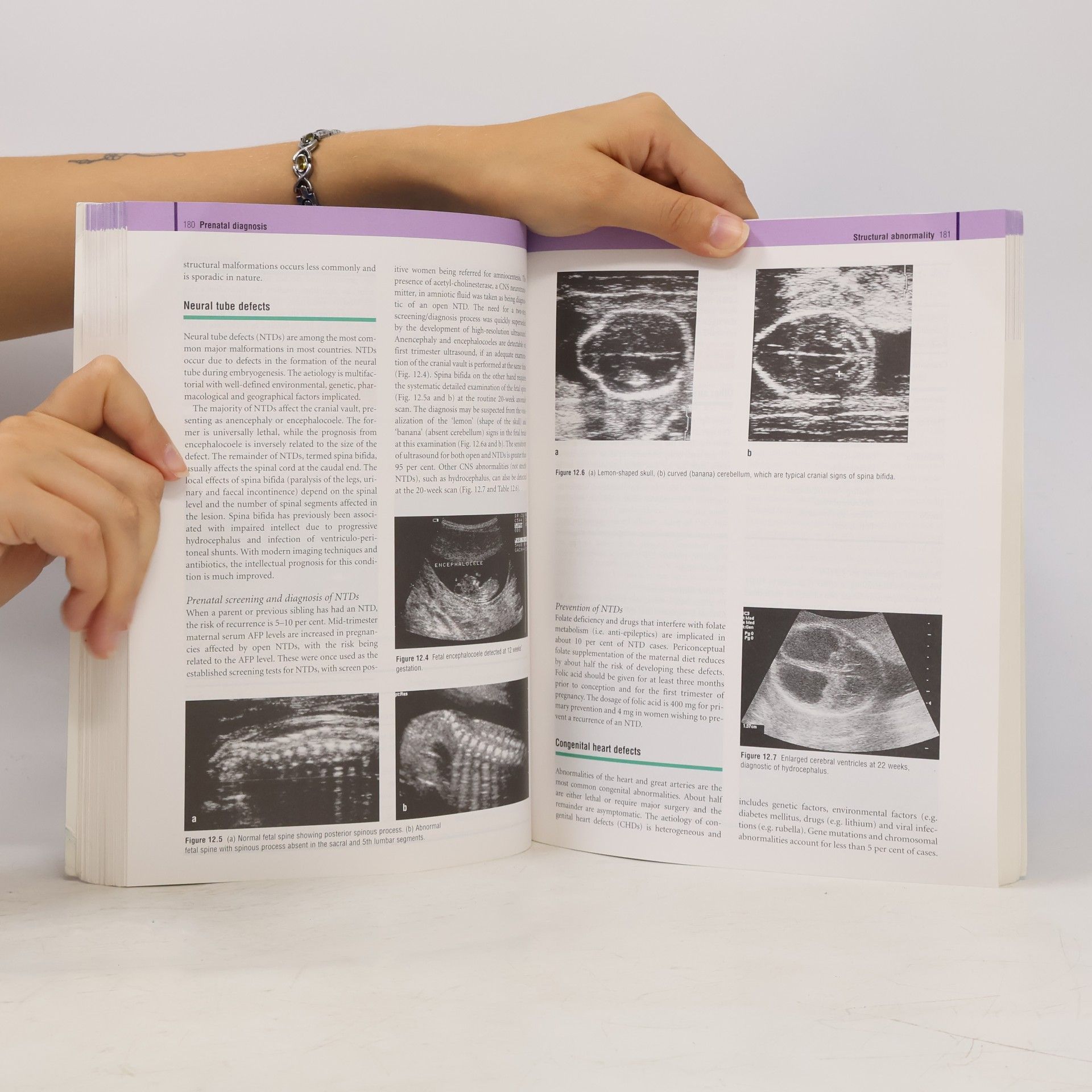 Stuart Campbell Obstetrics by Ten Teachers, 17th Edition
