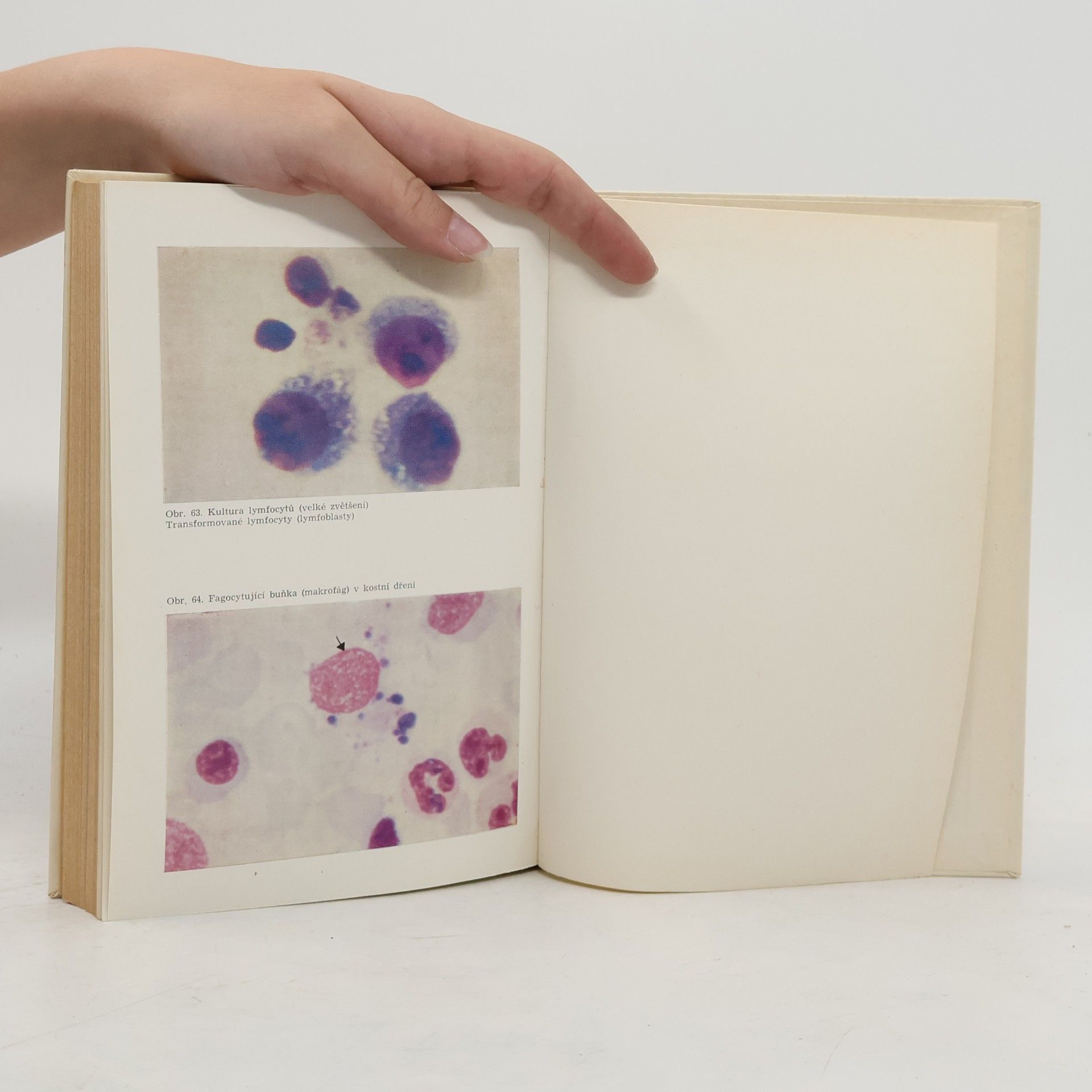 Mikuláš Hrubiško Hematologie a krevní transfúze 1: Hematologie
