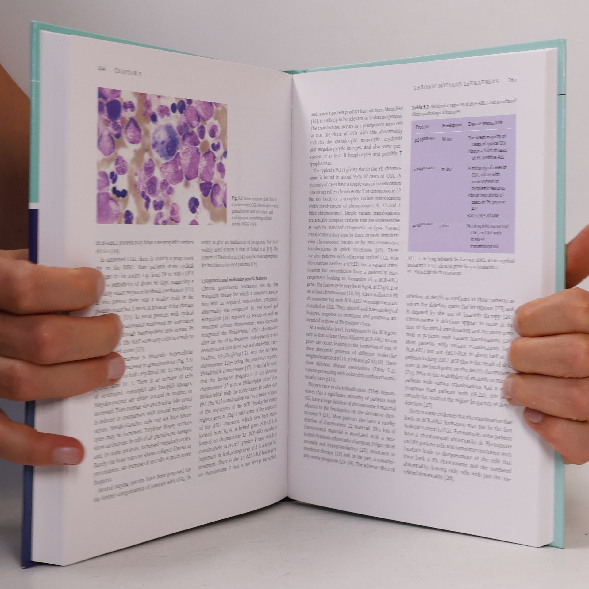 Barbara J. Bain Leukaemia Diagnosis - Fourth Edition