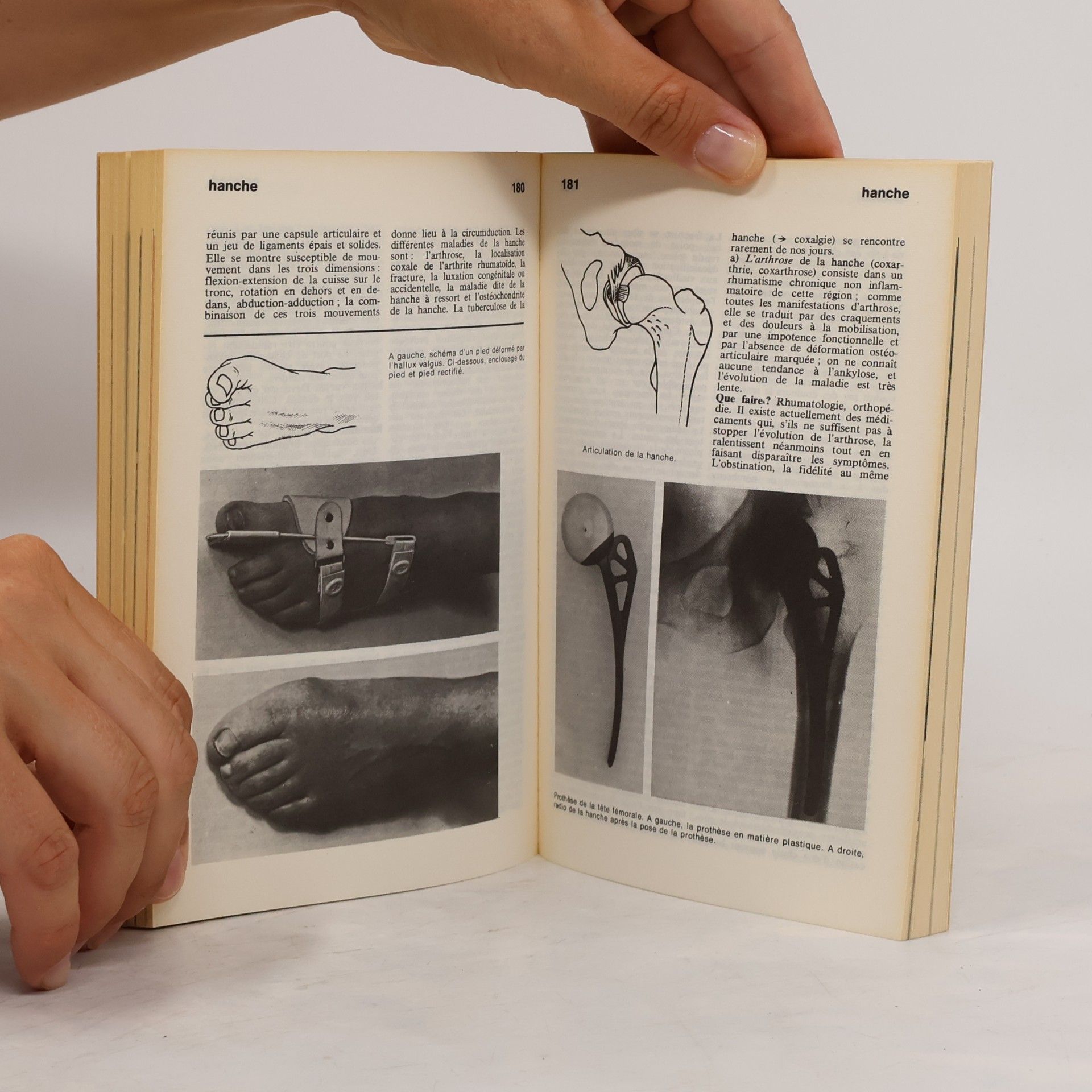 Collectif d'auteurs Le dictionnaire Marabout de la Médecine 3