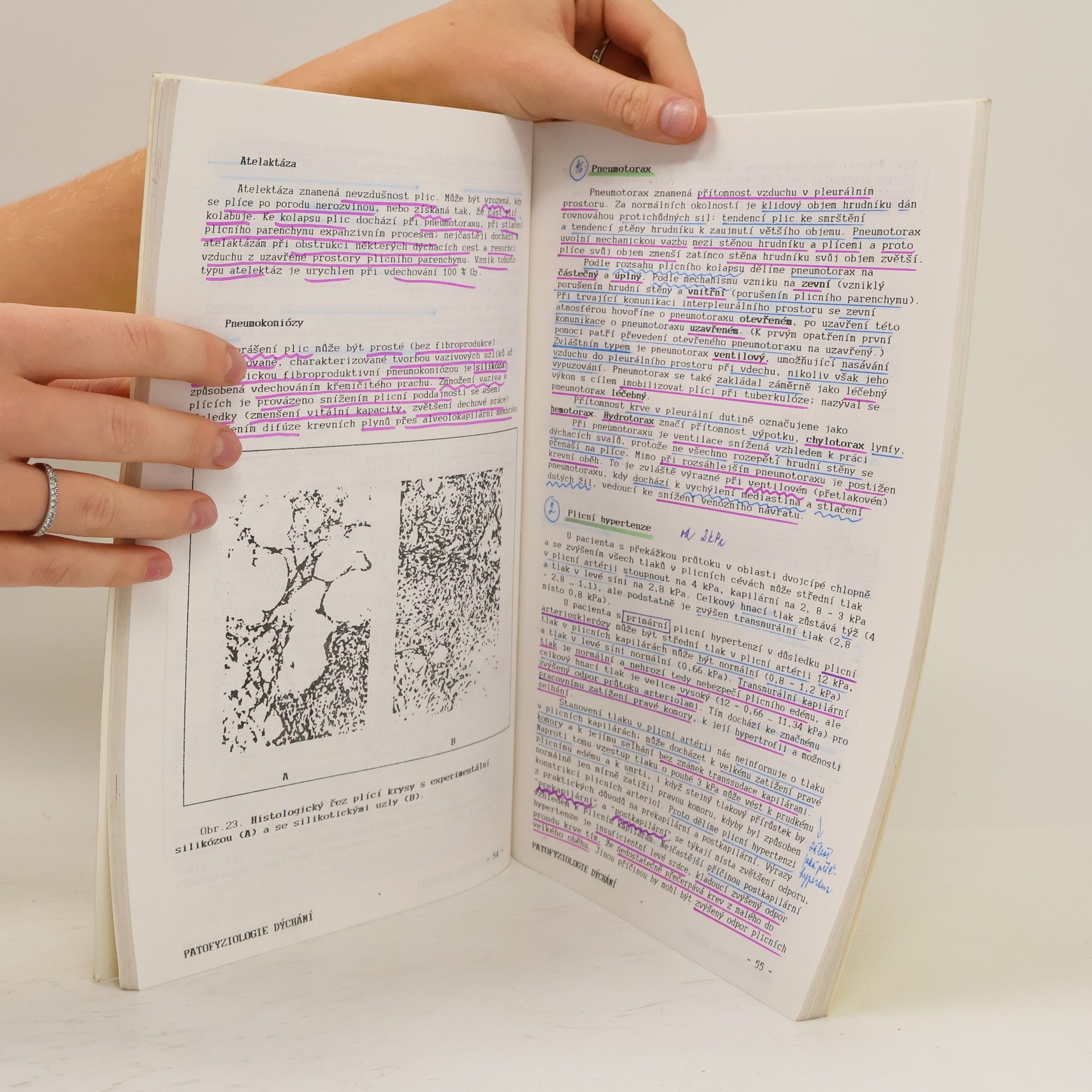 Kolektiv autorů Patofysiologie dýchání a oběhu
