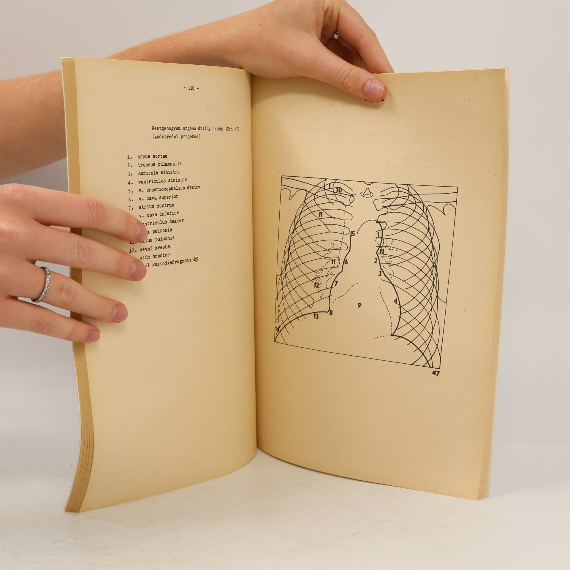 Autorenkollektiv Základy rentgenové anatomie