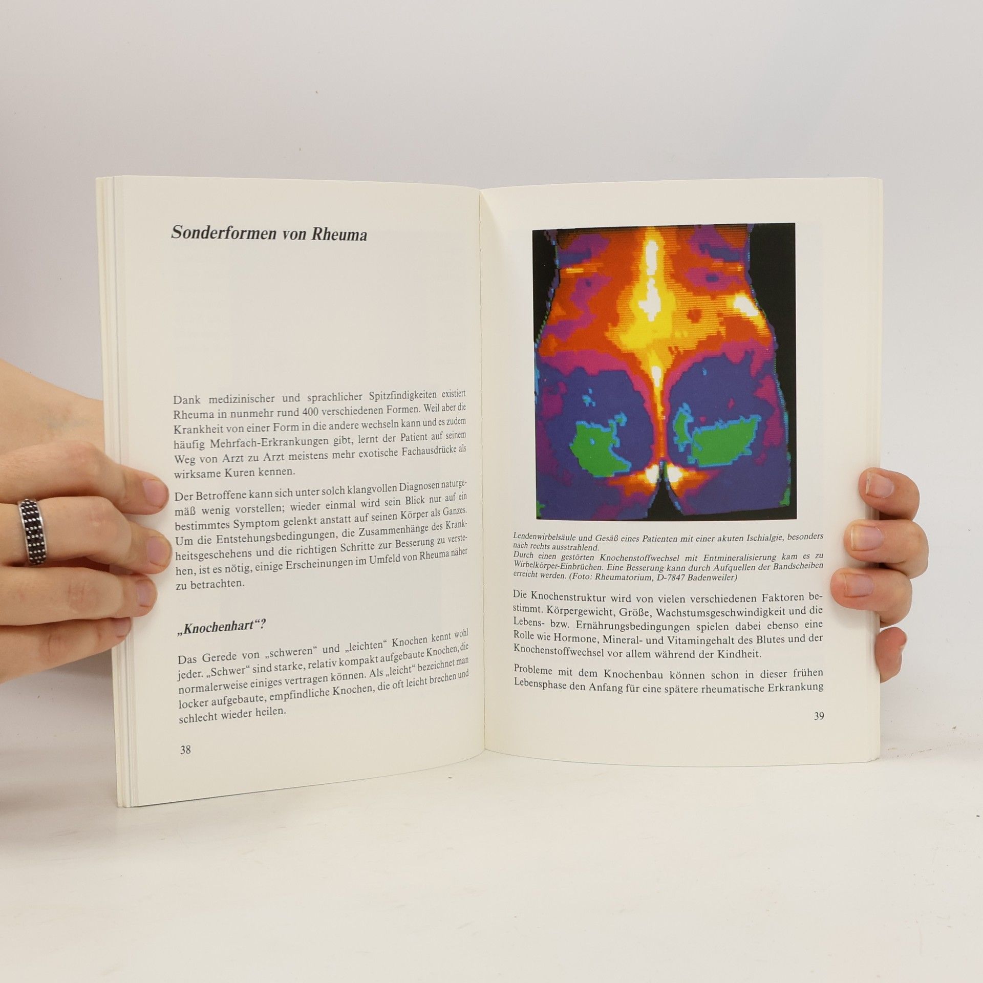 Ulrike Gabs Das Anti-Rheuma-Buch