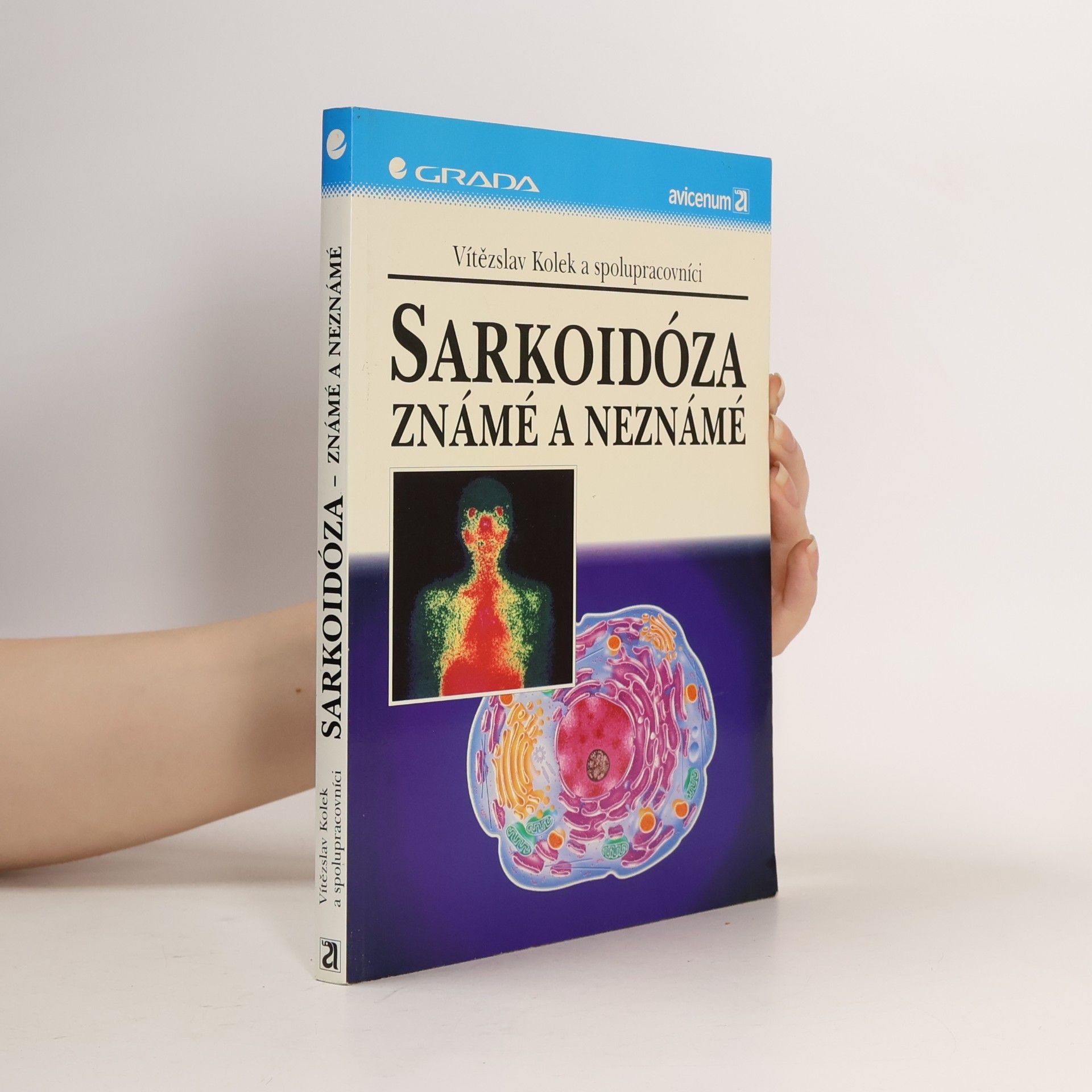 Sarkoidóza : známé a neznámé