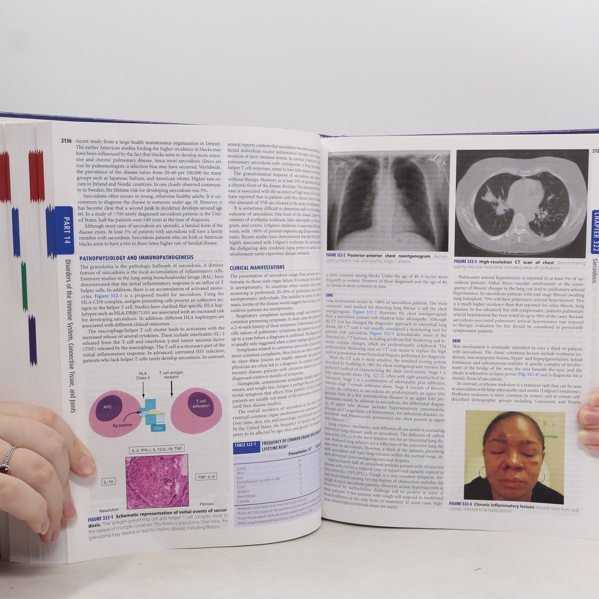 AA.VV. Harrison's Principles of Internal Medicine II.