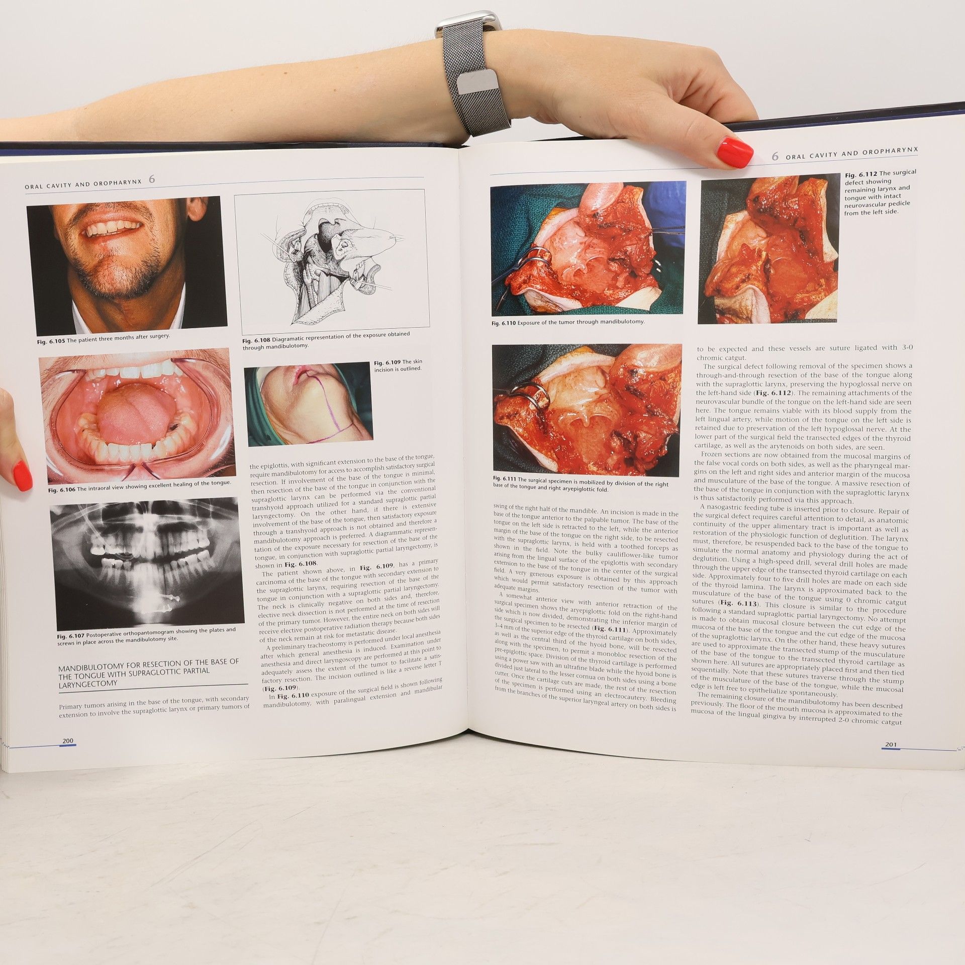 Snehal G. Patel Head and neck surgery and oncology