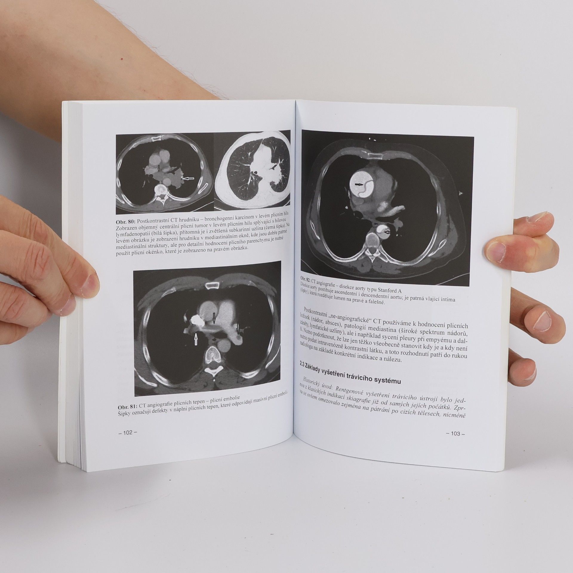 Hana Malíková Základy radiologie a zobrazovacích metod