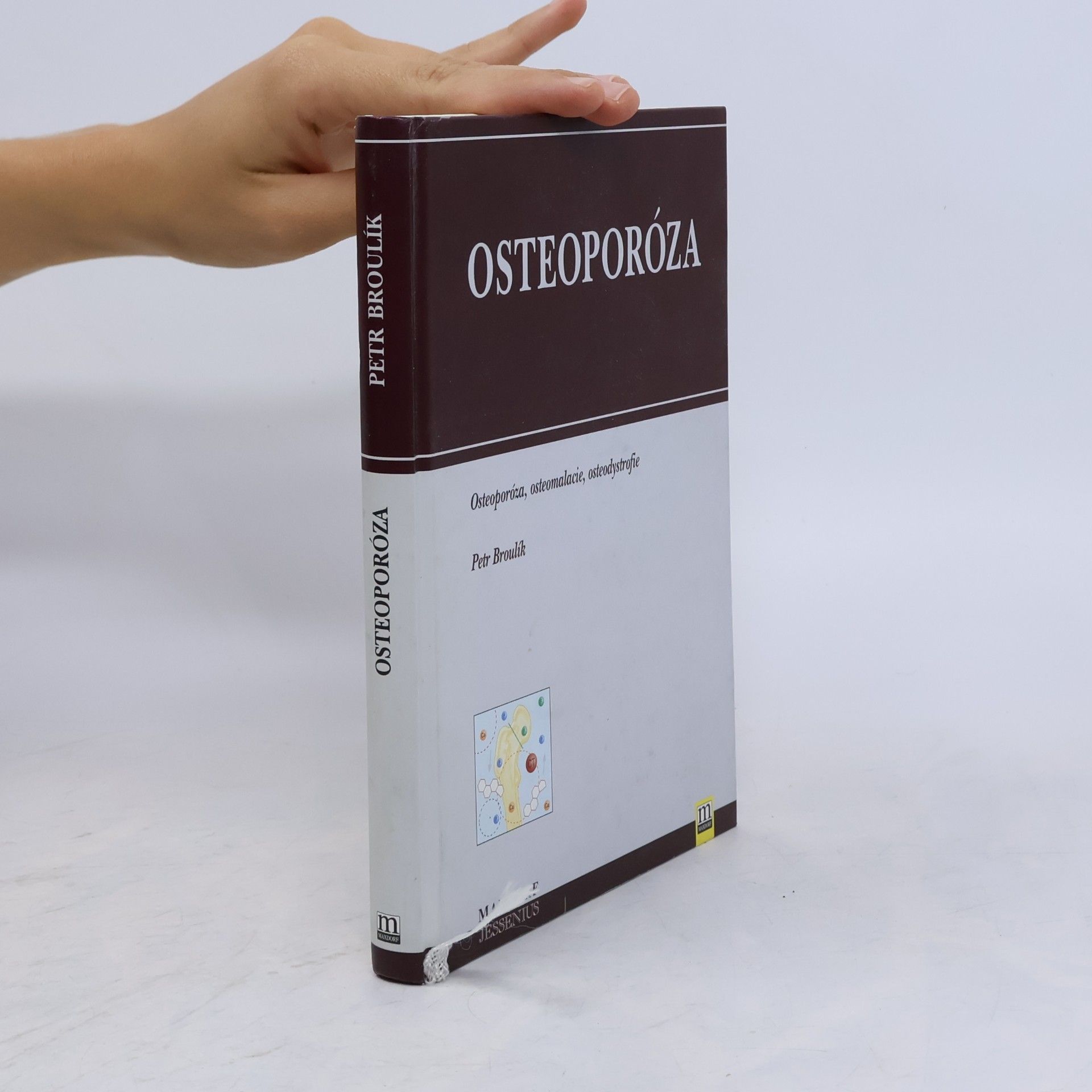 Petr Broulík Osteoporóza: osteoporóza, osteomalacie, osteodystrofie