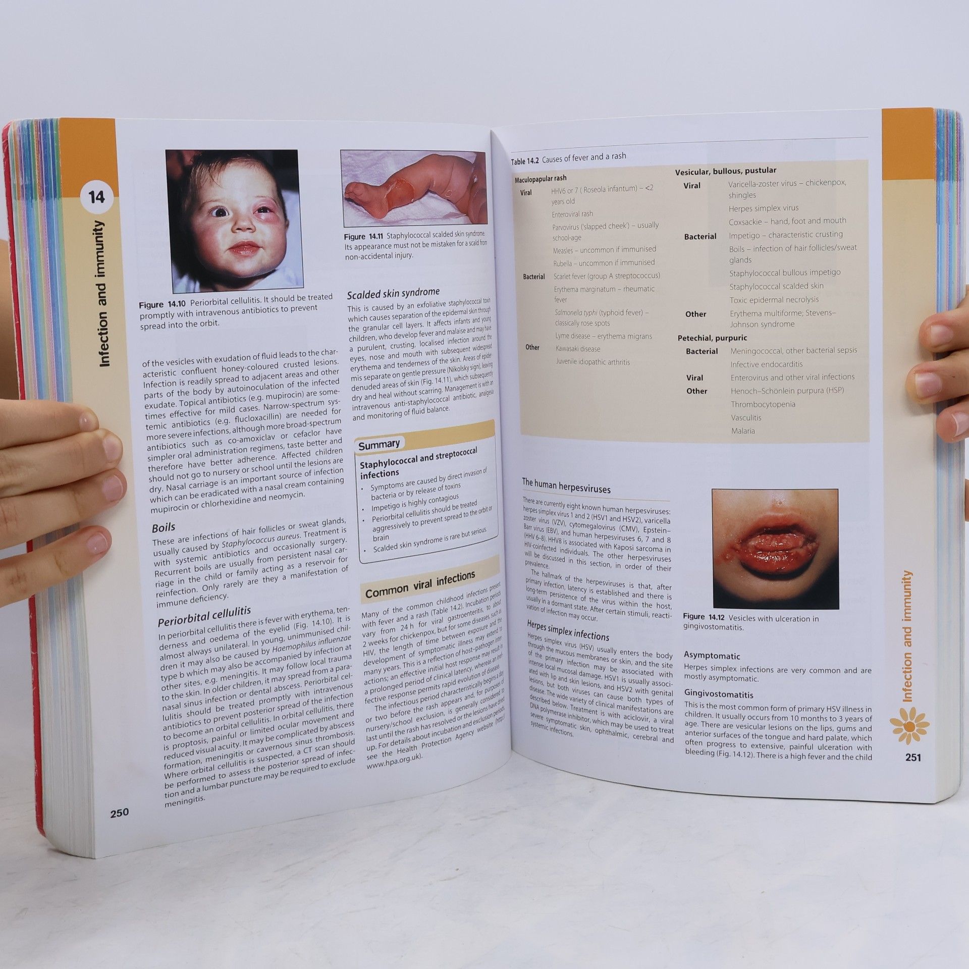Tom Lissauer Illustrated Textbook of Peadiatric
