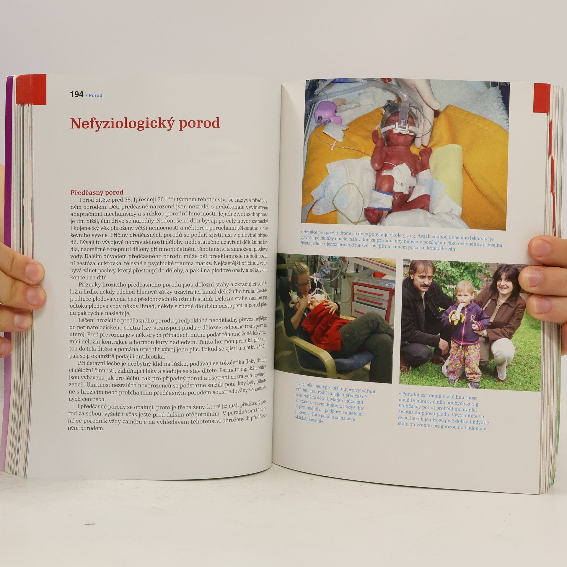 Antonín Pařízek Kniha o těhotenství, porodu a dítěti. 2. díl, Porod
