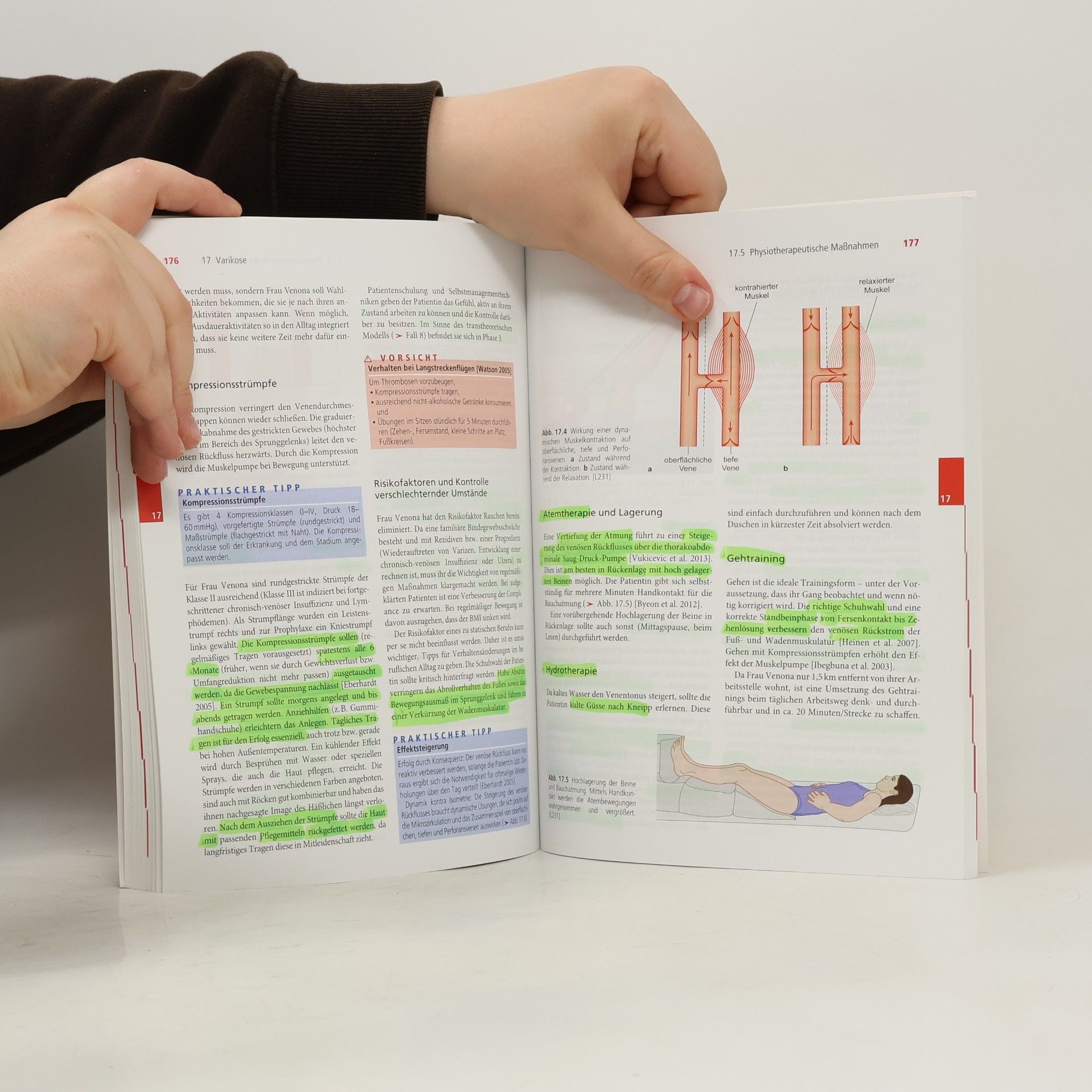 Susanne Mayrhofer Fallbuch Physiotherapie: Innere Medizin mit Schwerpunkt Kardiologie/Pulmologie