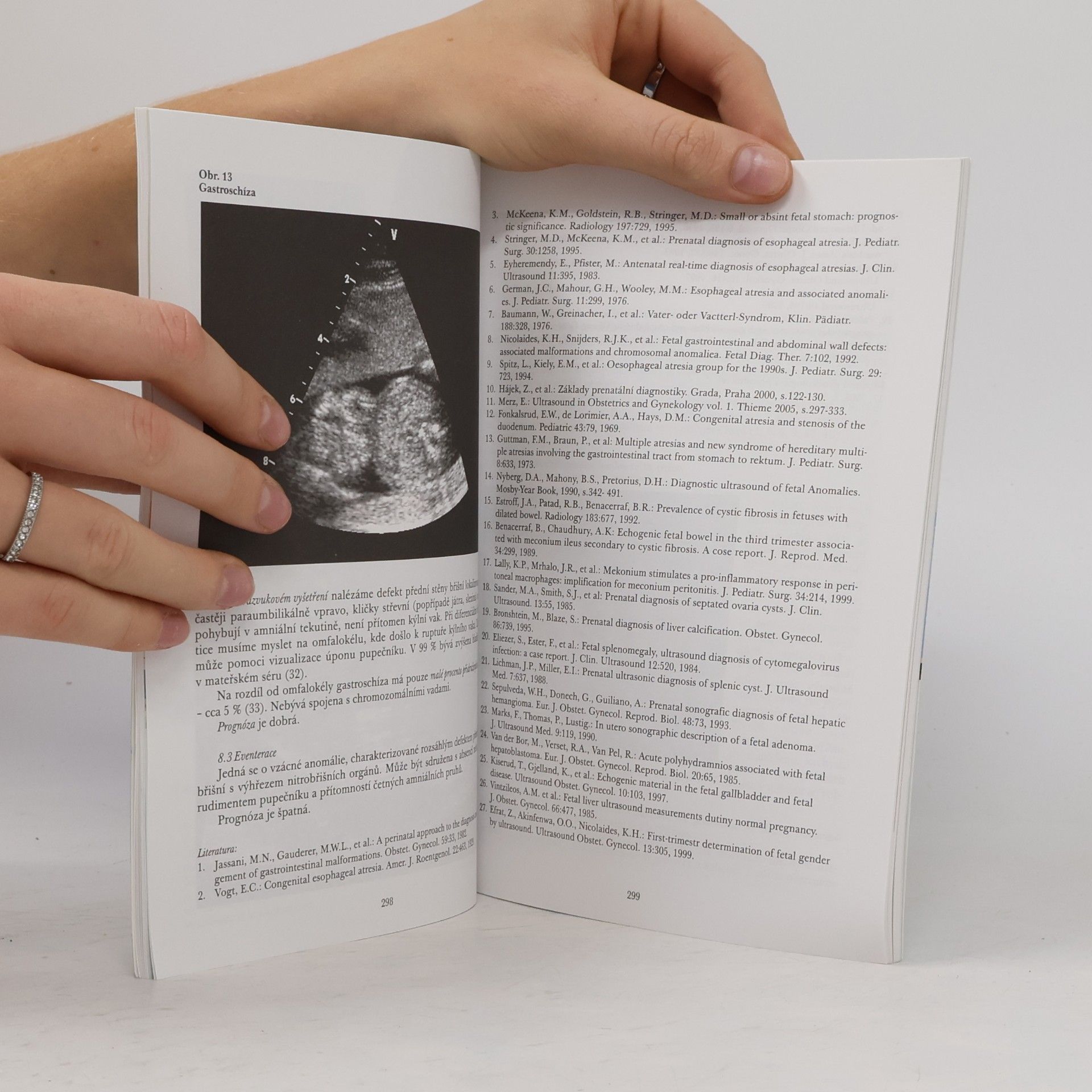 Kolektiv autorů Prenatální ultrazvuková diagnostika II.