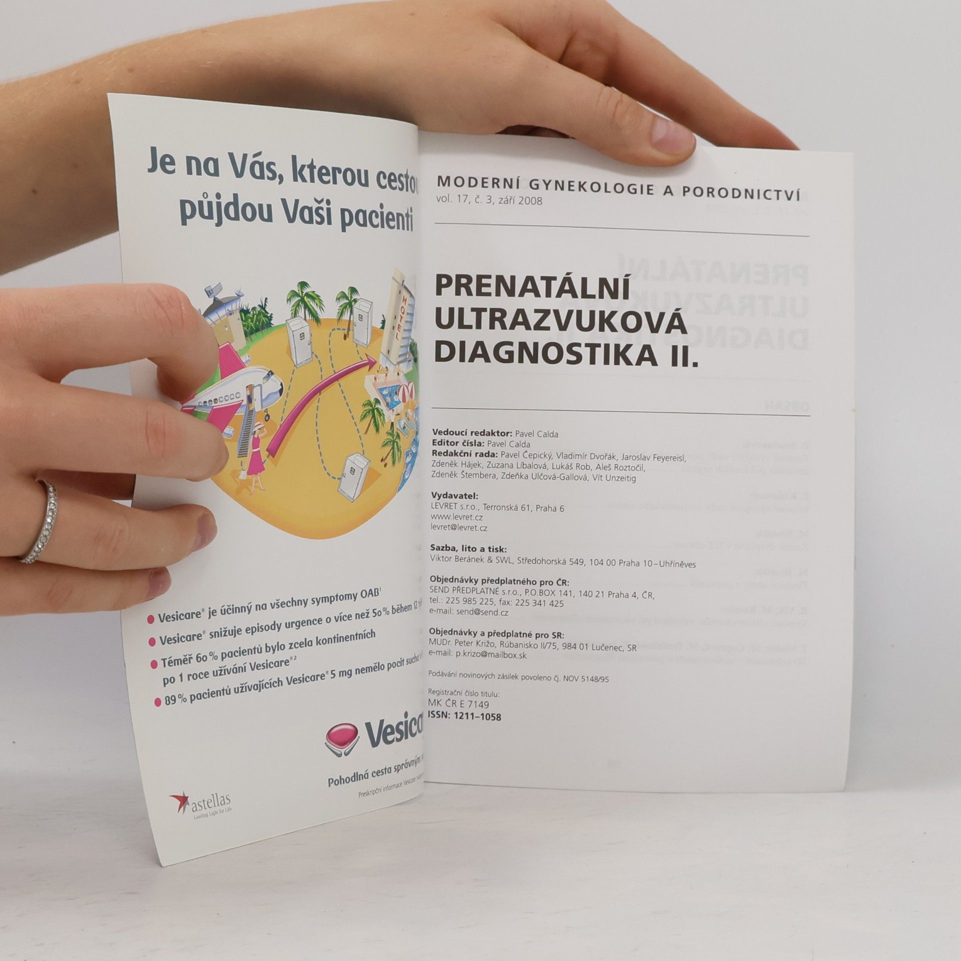 Kolektiv autorů Prenatální ultrazvuková diagnostika II.