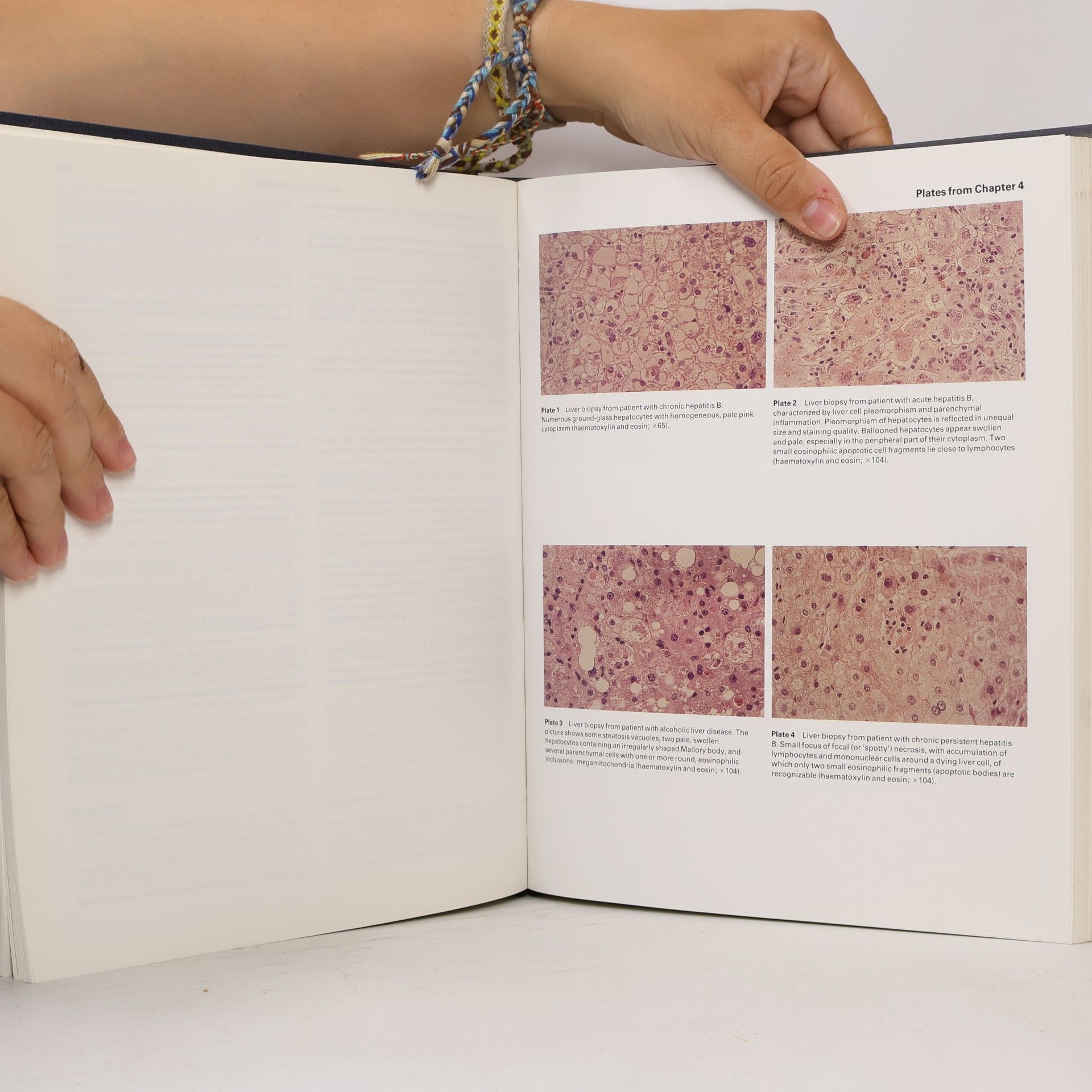 Johannes Bircher Oxford Textbook of Clinical Hepatology 1