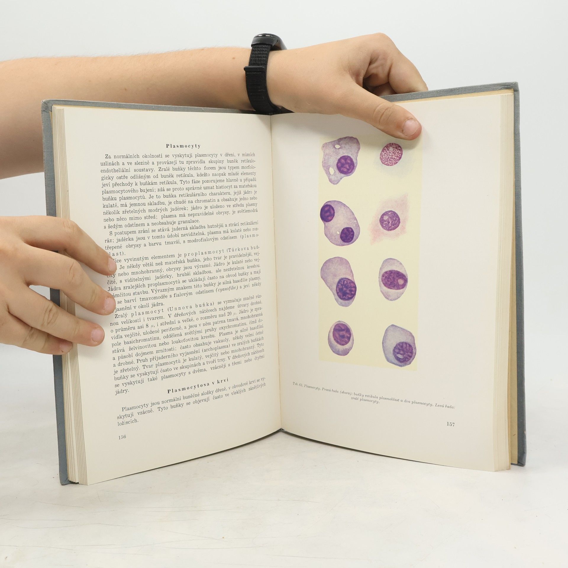 Włodzimierz Ławkowicz Hematologický atlas
