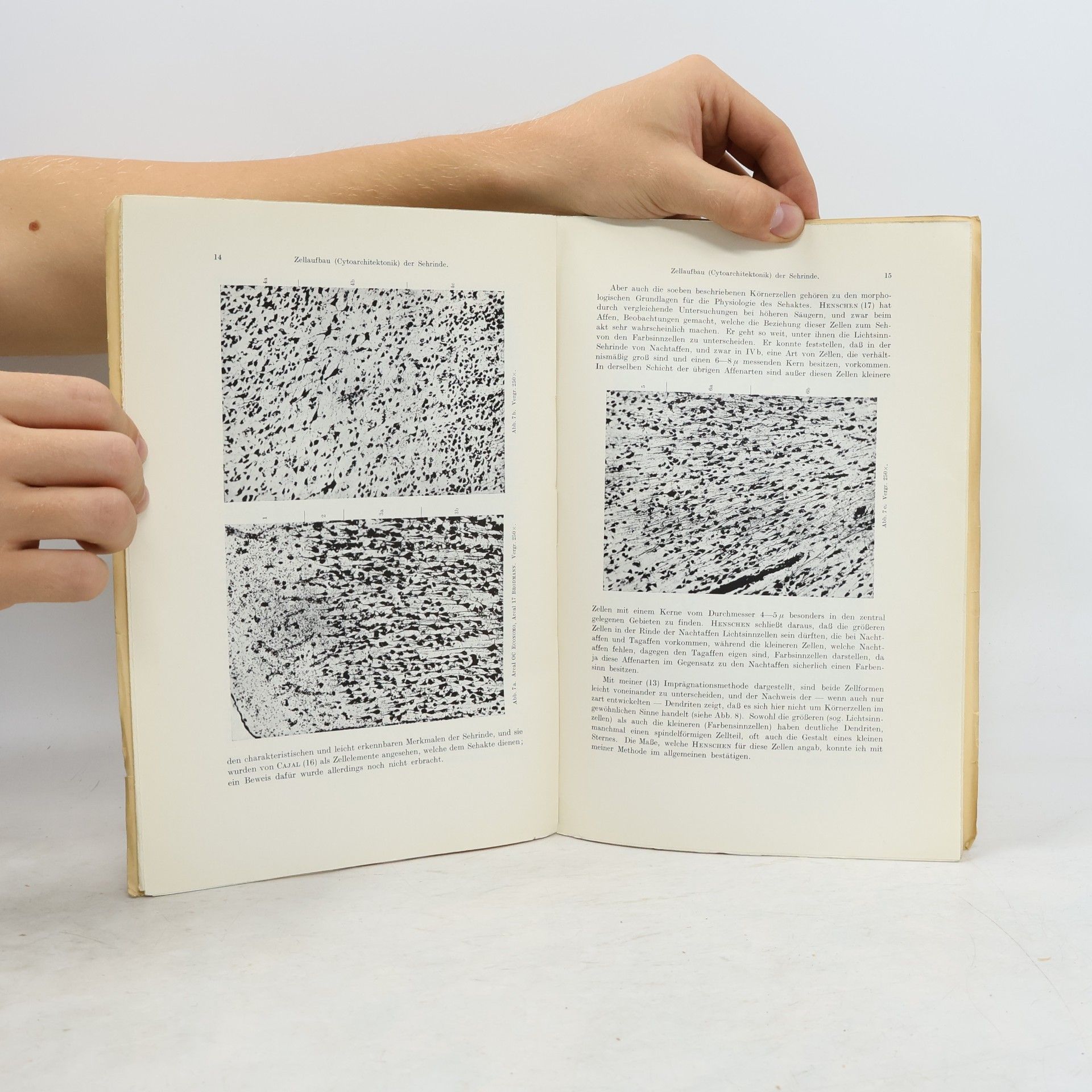 Max de Crinis Anatomie der Sehrinde