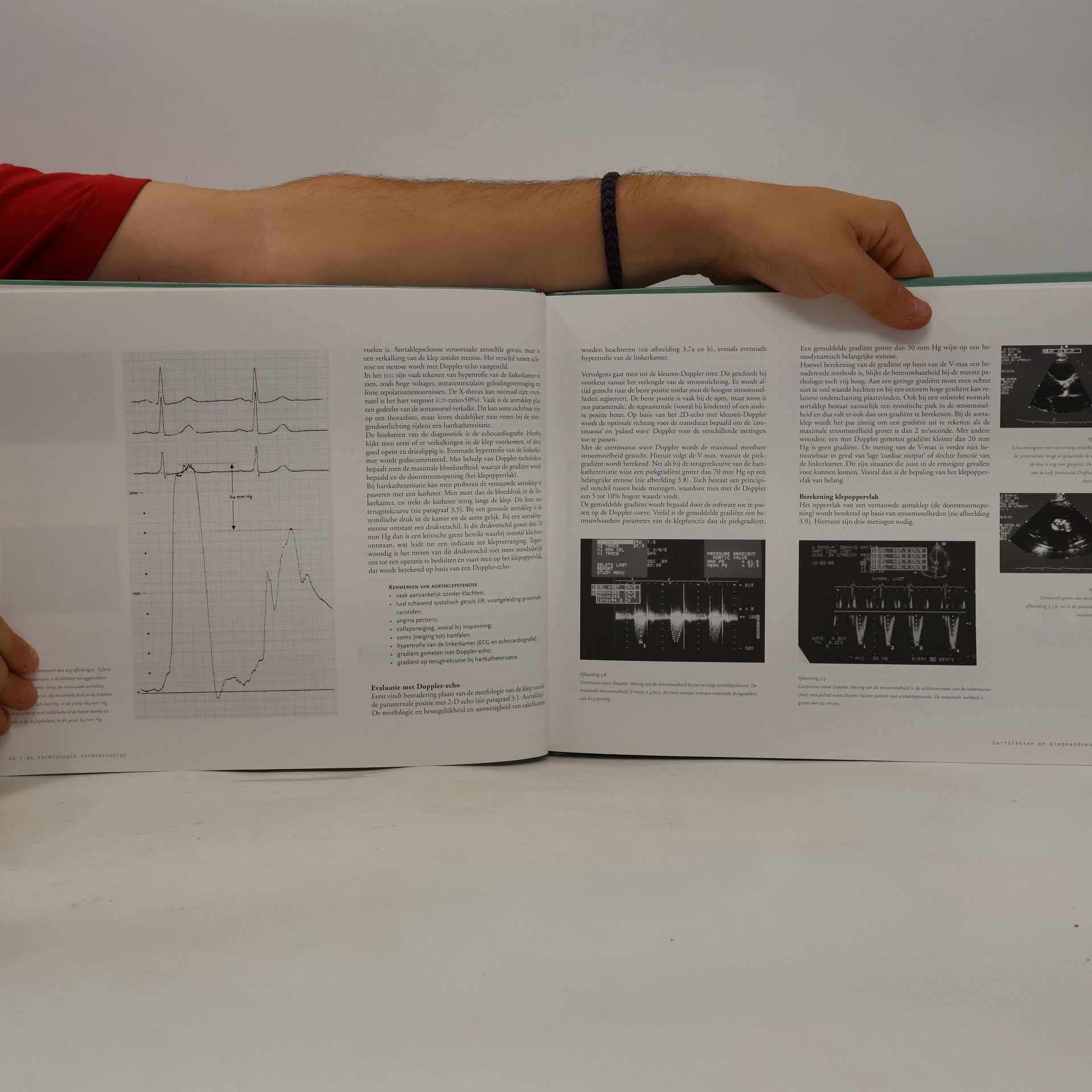A. J. Six De cardiologie vereenvoudigd