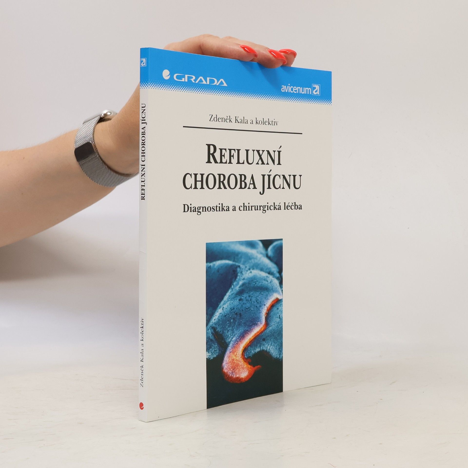 Refluxní choroba jícnu : diagnostika a chirurgická léčba