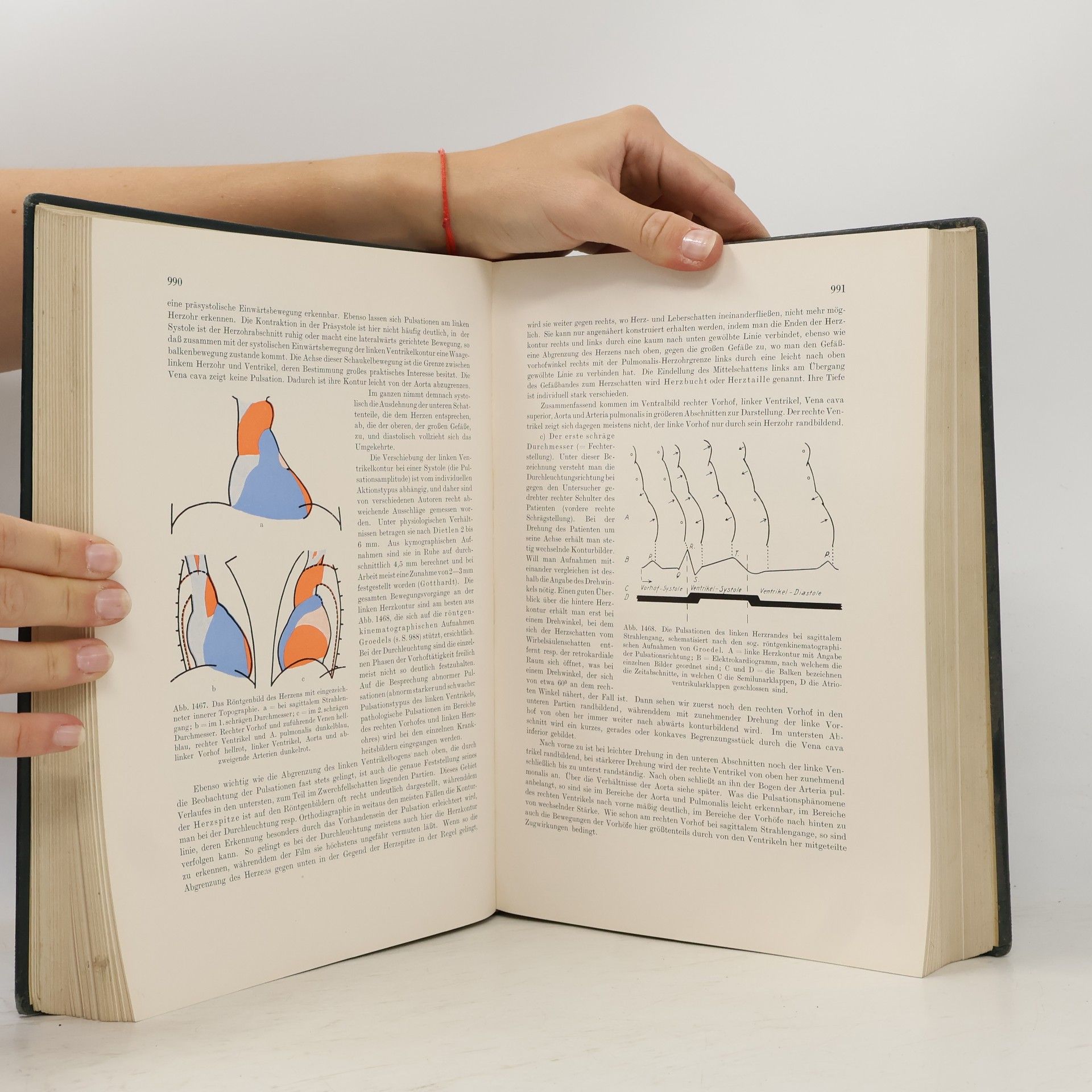 Autorenkollektiv Lehrbuch der Röntgendiagnostik II. Innere Organe