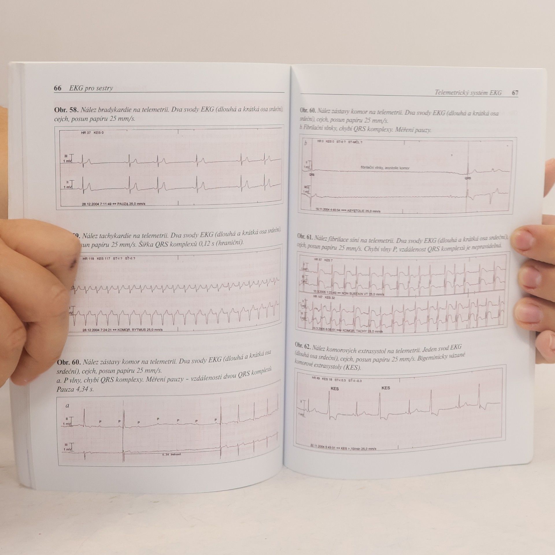 Eliška Sovová EKG pro sestry