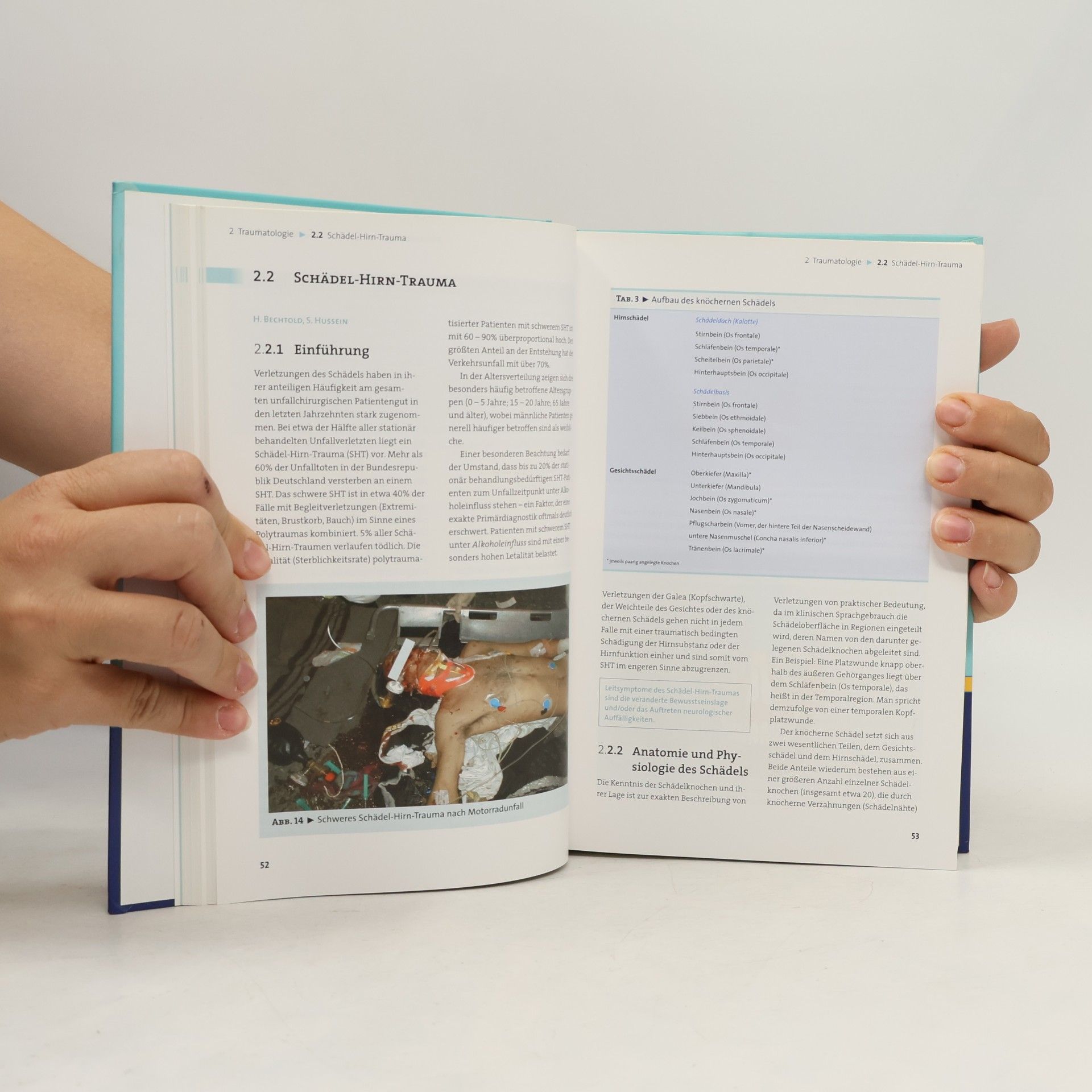 Autorenkollektiv Schwerpunkt Traumatologie