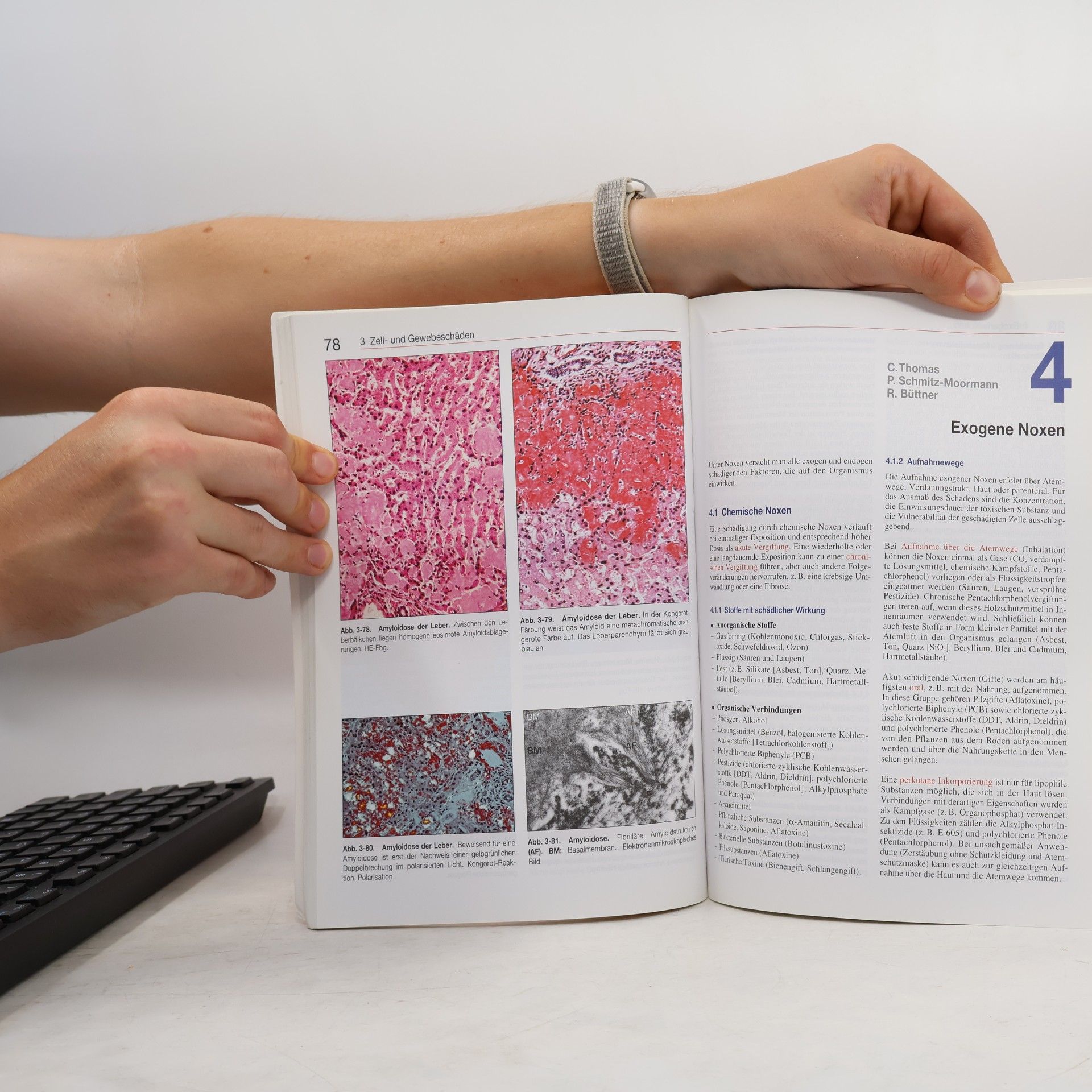 Reinhard Büttner Allgemeine Pathologie - 3. Auflage