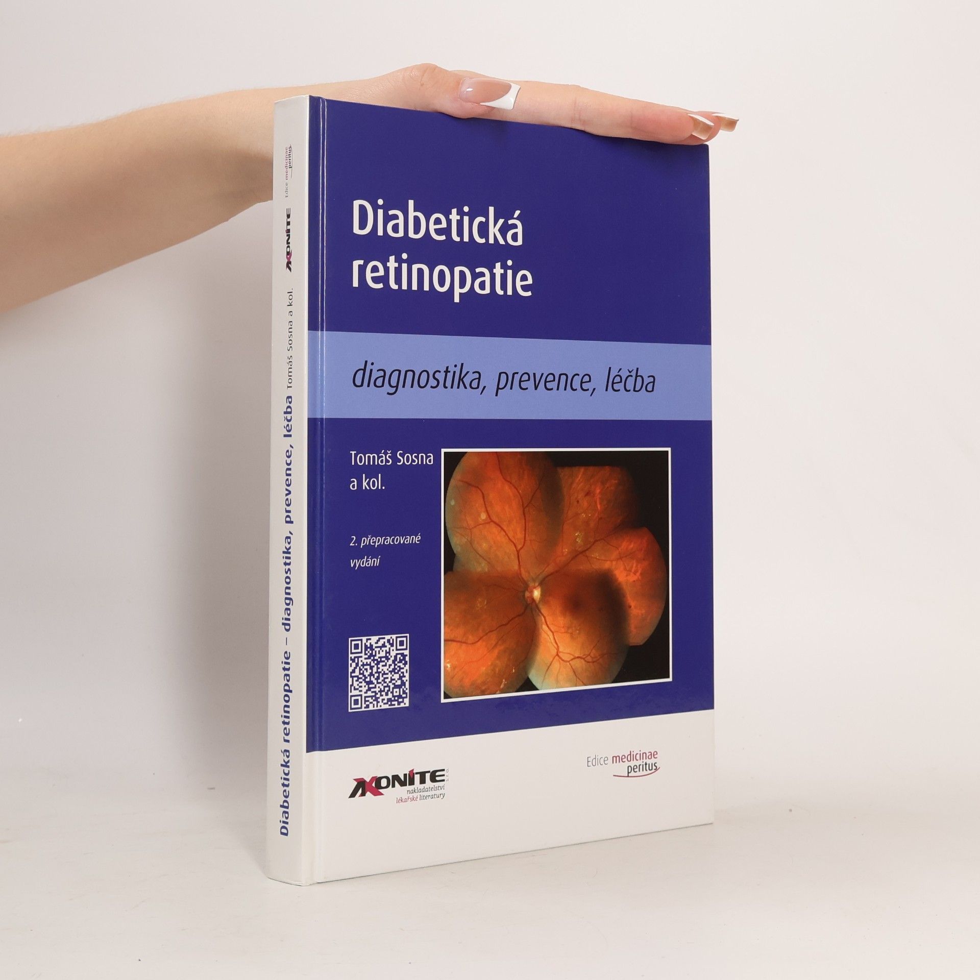 Tomáš Sosna Diabetická retinopatie
