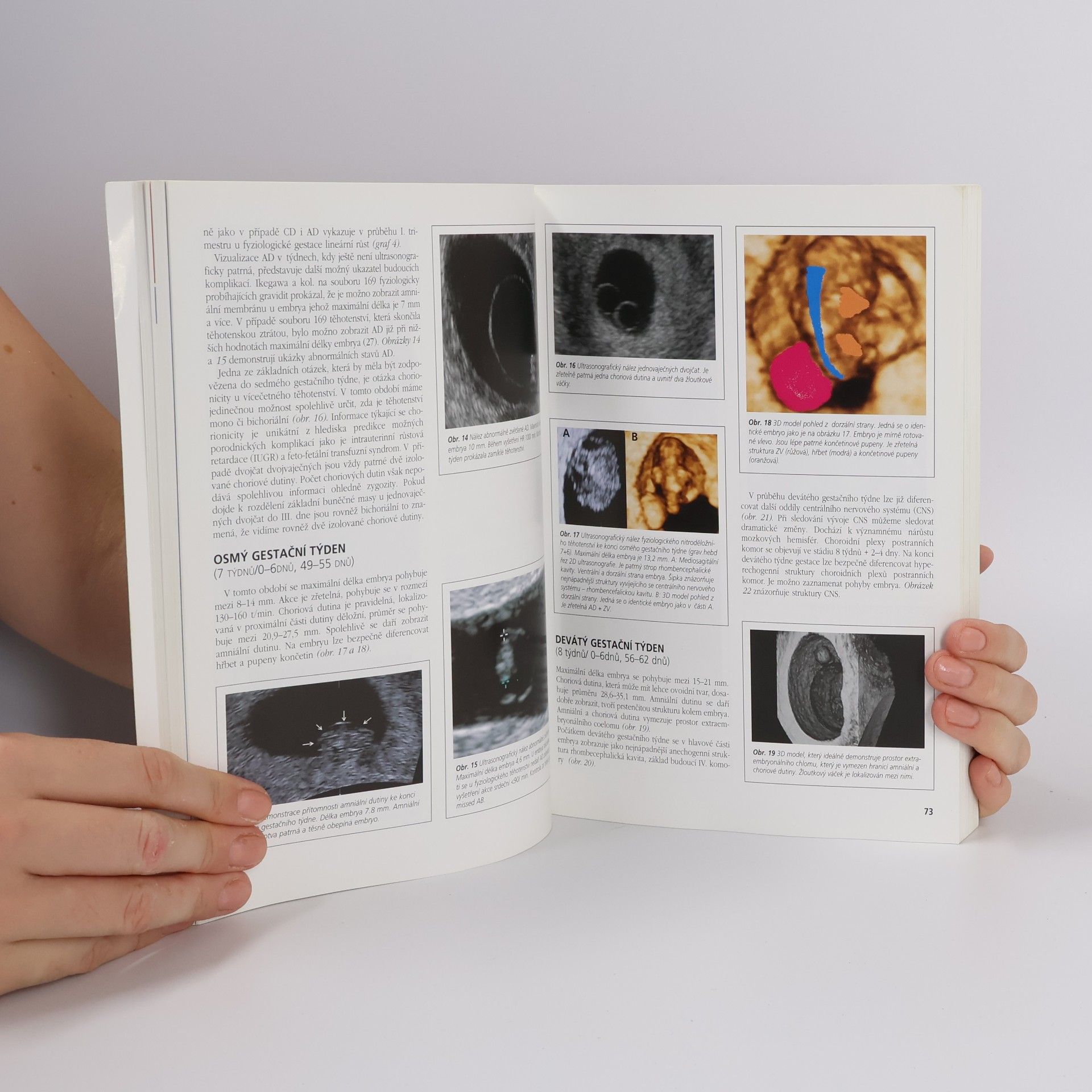 Pavel Calda Ultrazvuková diagnostika v těhotenství a gynekologii