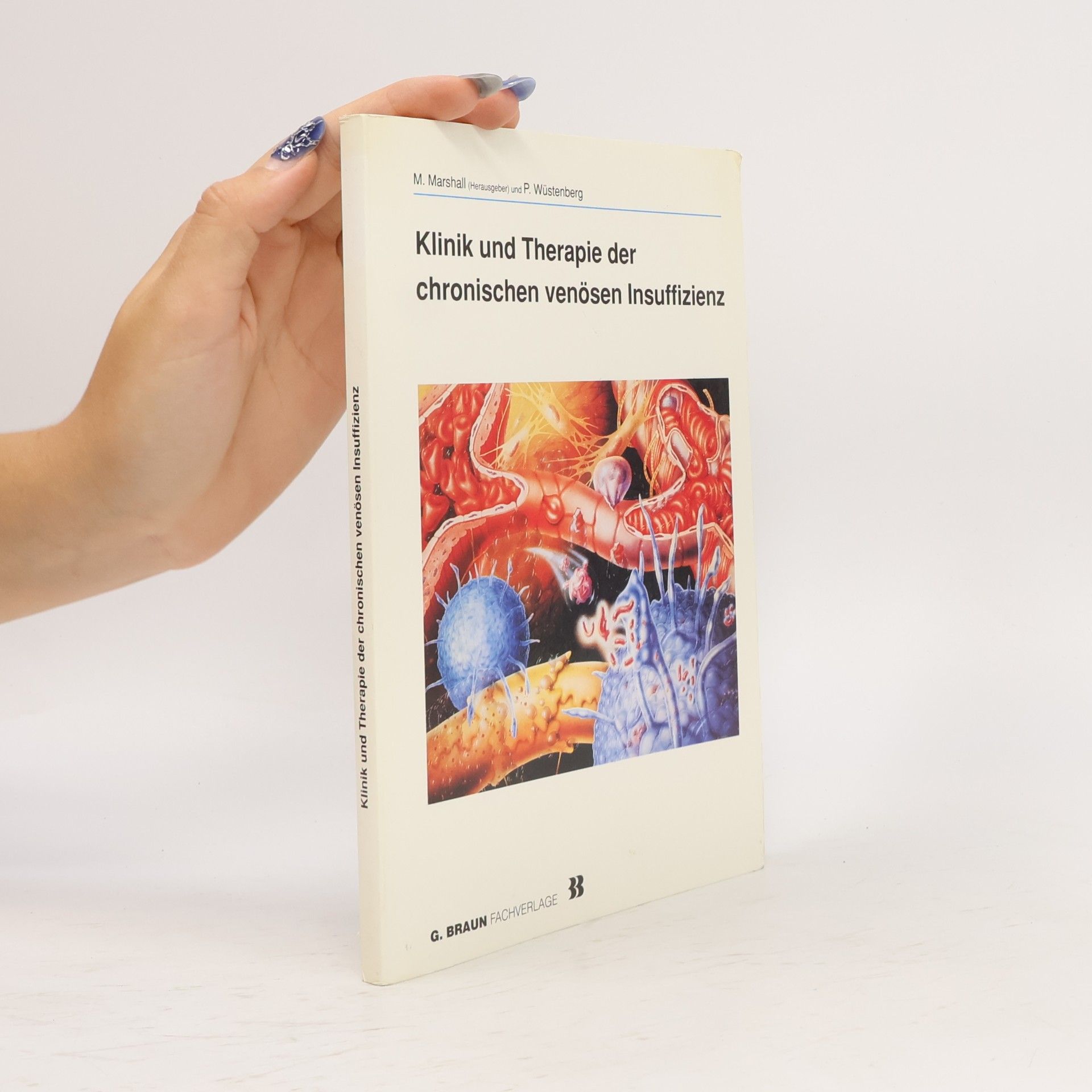Markward Marshall Klinik und Therapie der chronischen venösen Insuffizienz
