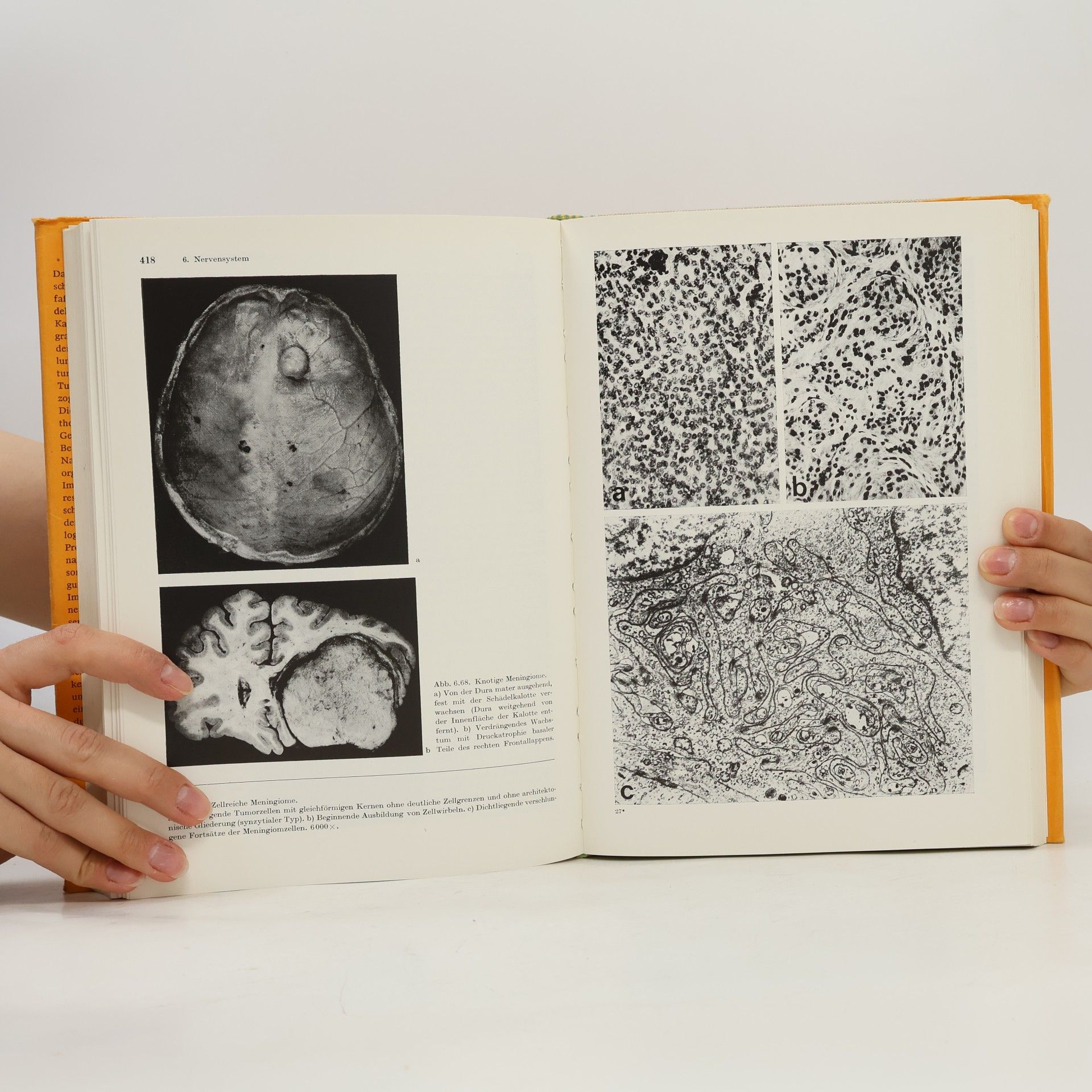 Autorenkollektiv Spezielle Pathologie 1