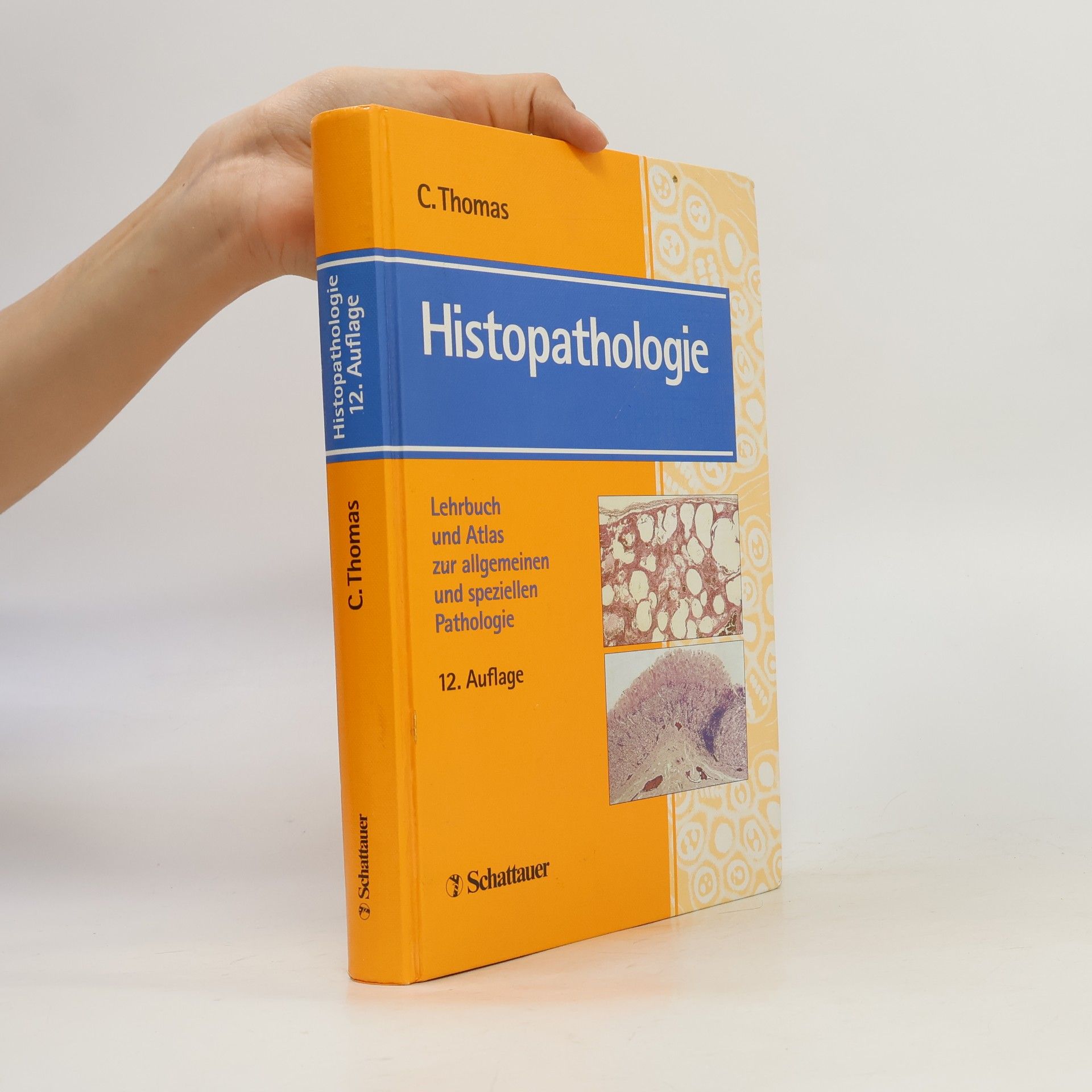 Carlos Thomas Histopathologie