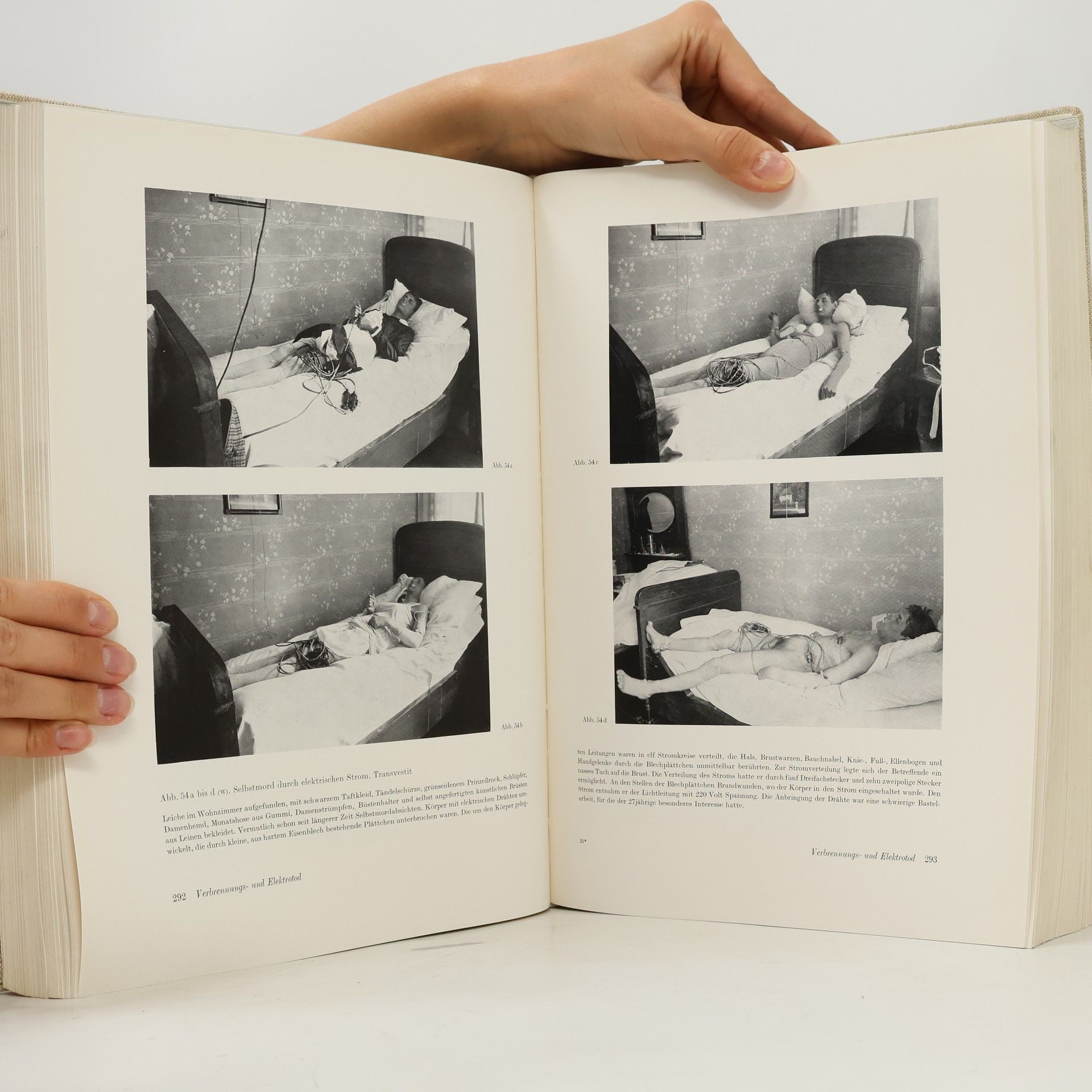 Waldemar Weimann Atlas der gerichtlichen Medizin