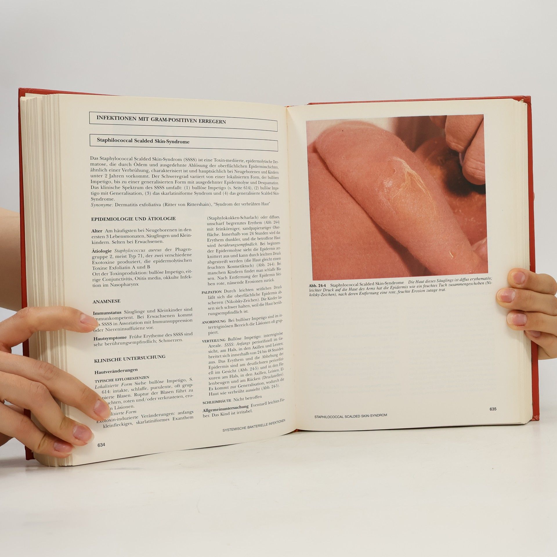 Thomas B. Fitzpatrick Atlas und Synopsis der klinischen Dermatologie - 3. Auflage