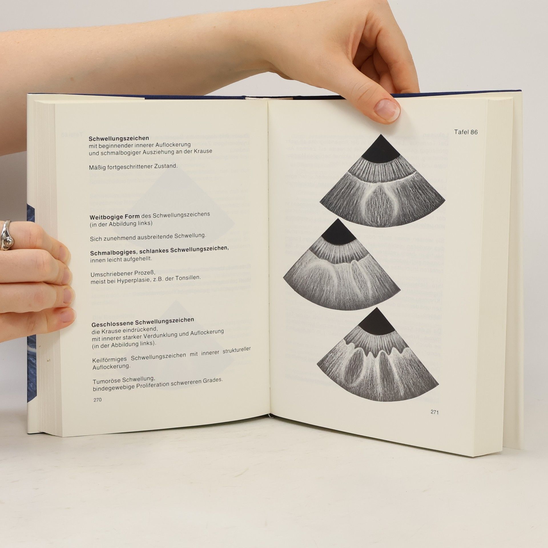 Joachim Broy Repertorium der Irisdiagnose