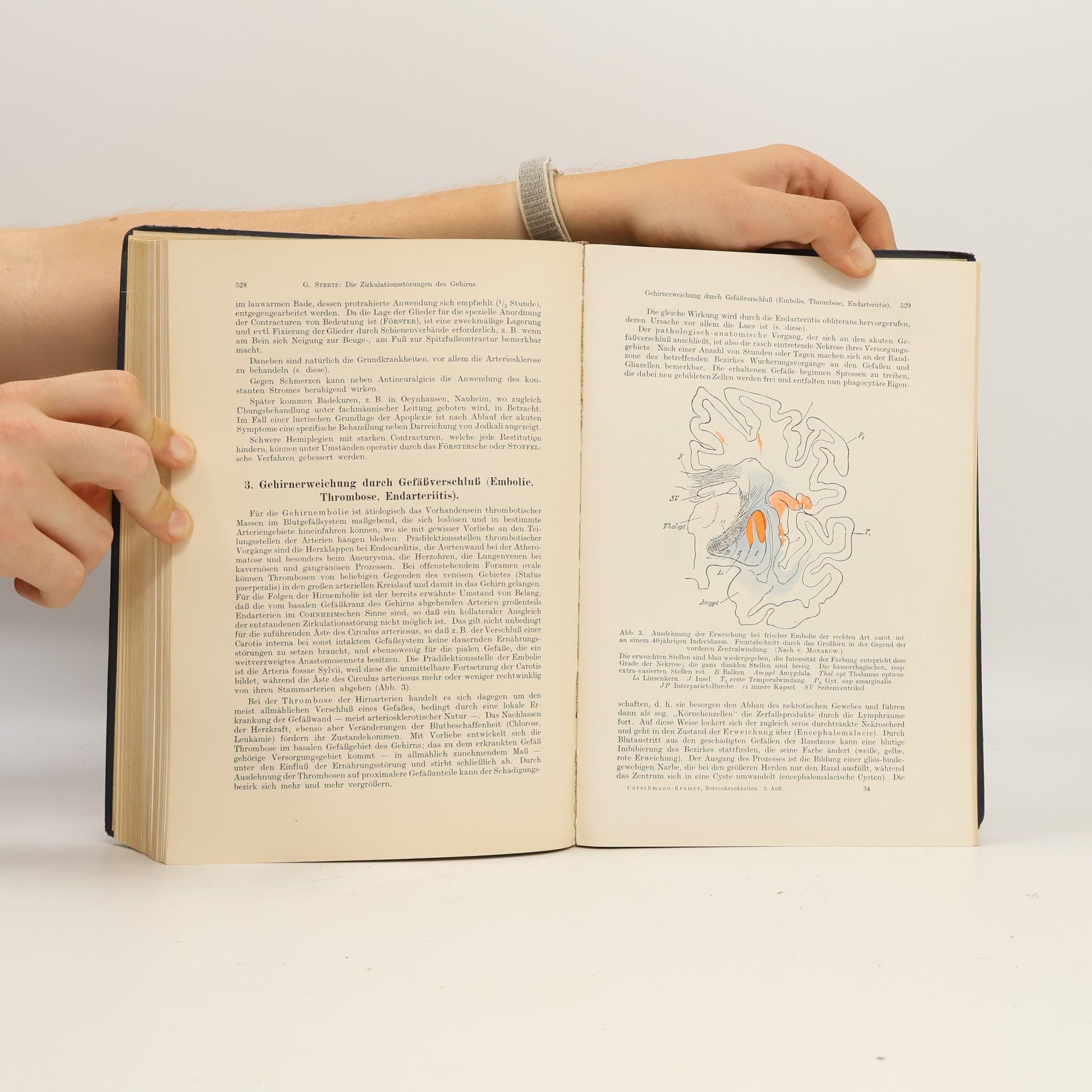 Hermann Oppenheim Lehrbuch der Nervenkrankheiten