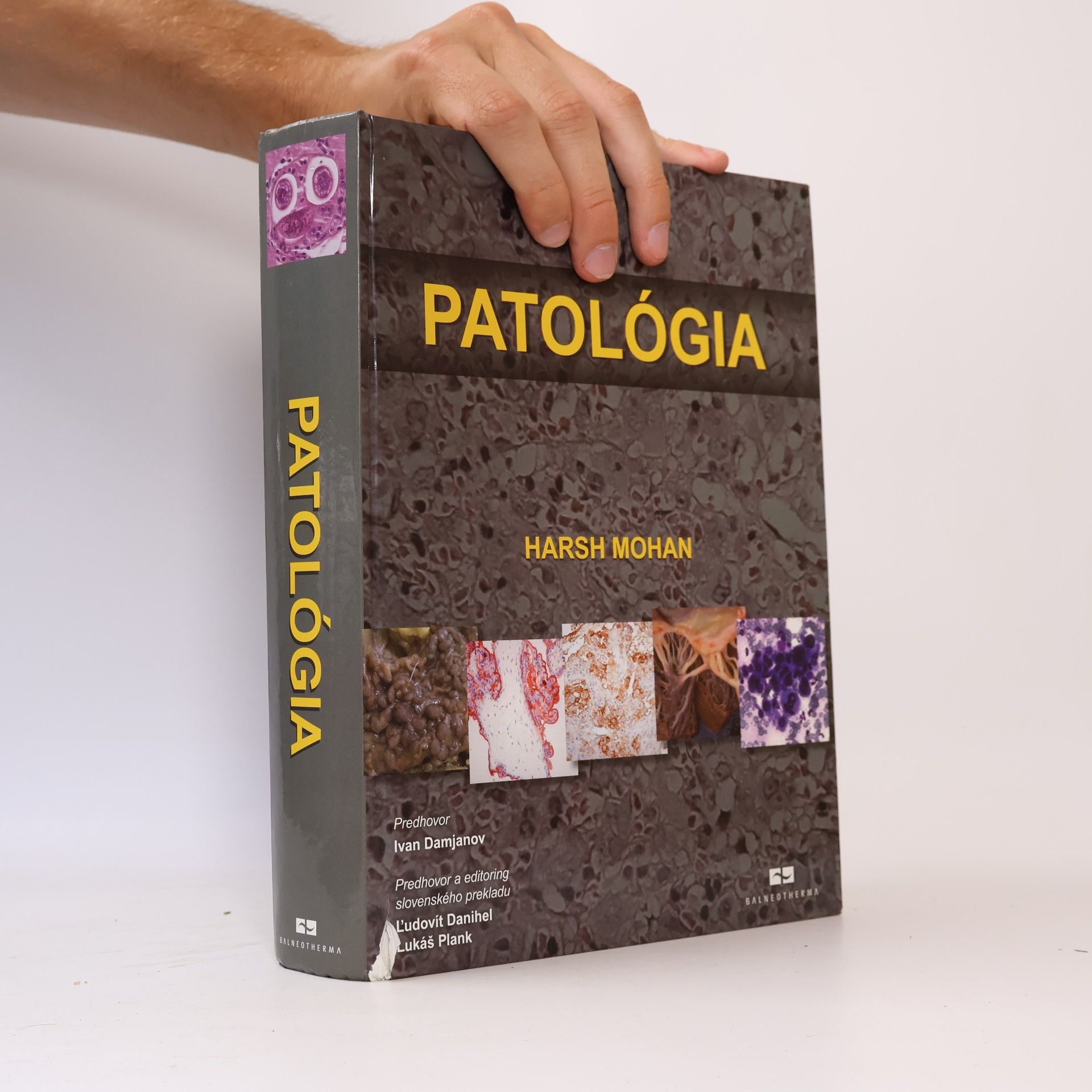Harsh Mohan Patológia